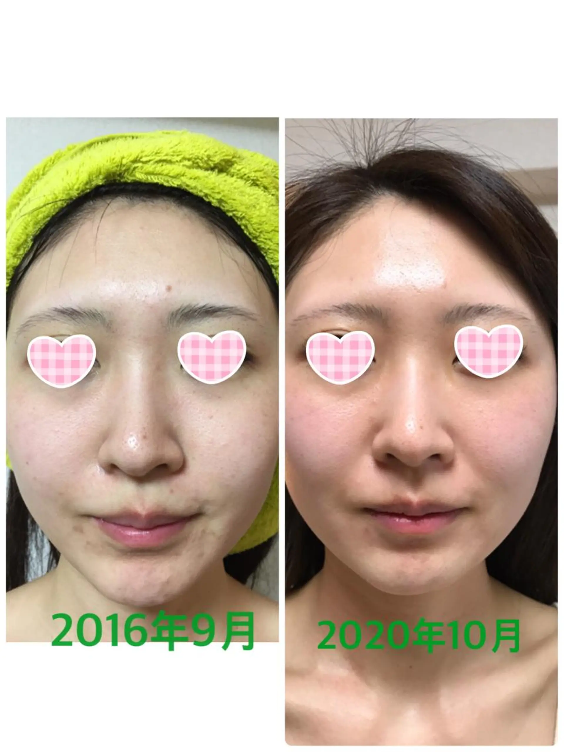 横浜ビューティーファクトリーHANA元町店所属・エステ&アロマ HANAのエステ・リラクイメージ