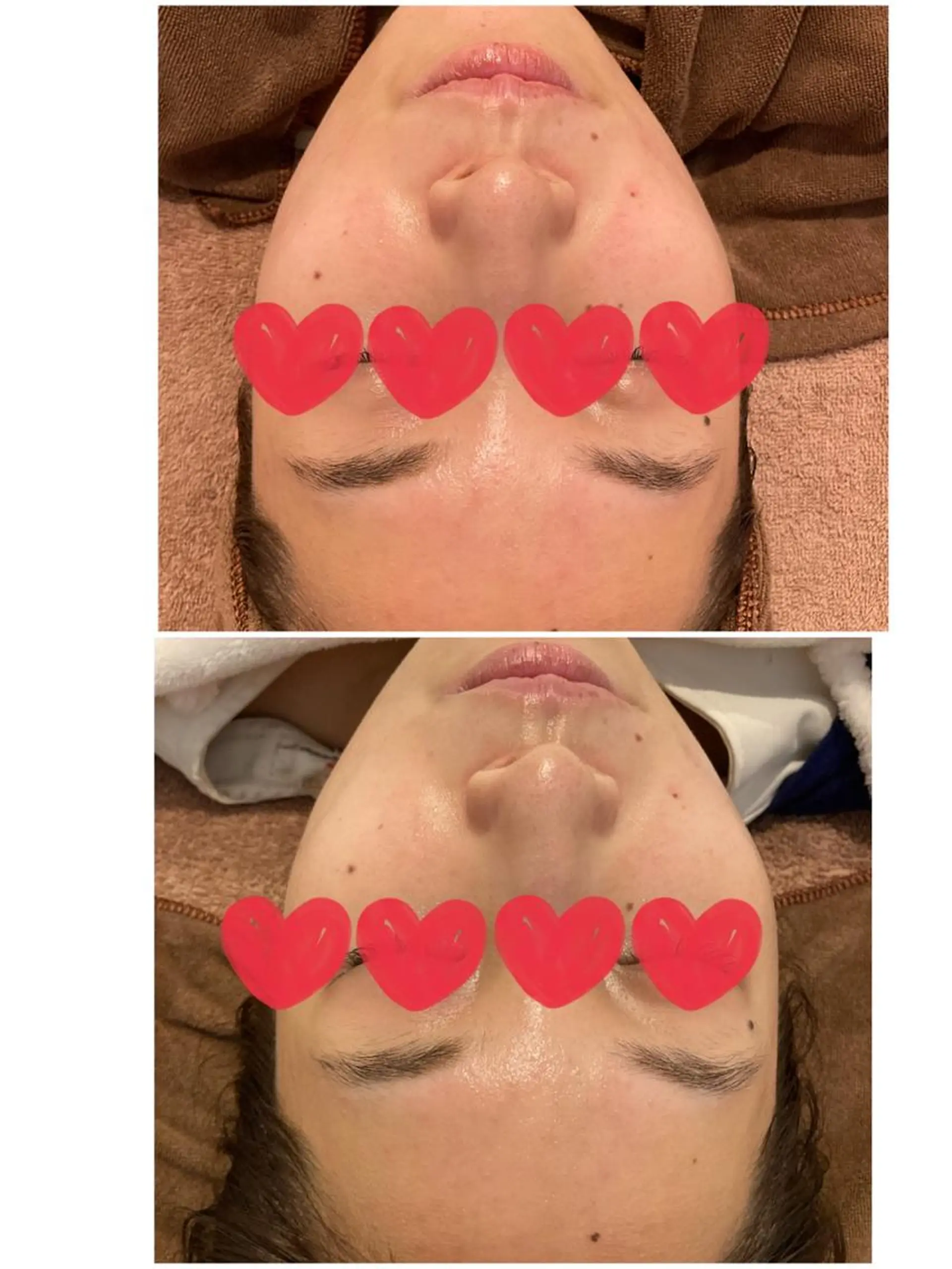 脱毛 ULULU 上野店のエステ・リラクイメージ