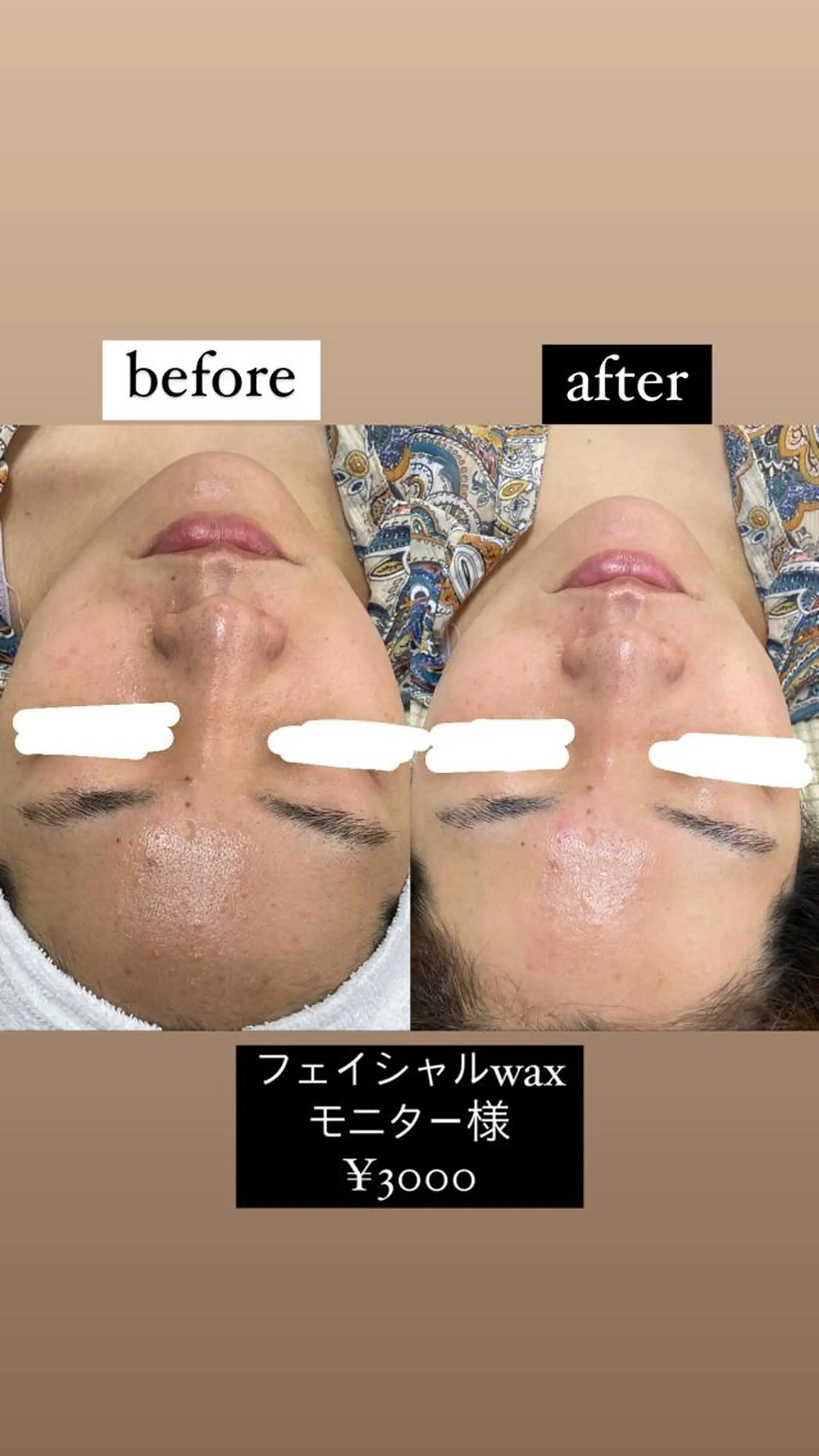 脱毛 Lotus. makoのエステ・リラクイメージ