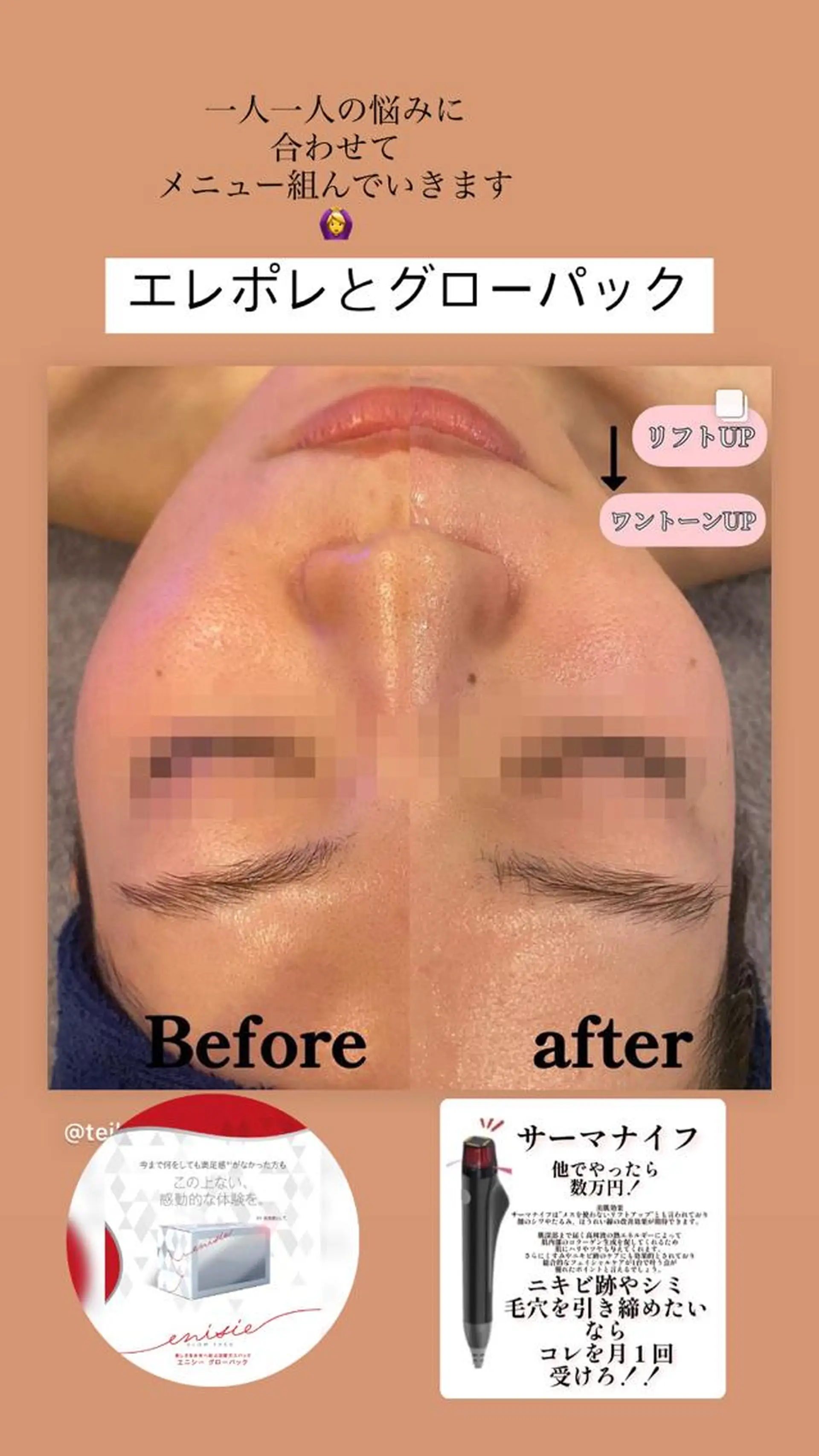 TEIKOKU所属・トータルビューティー TEIKOKUのエステ・リラクイメージ