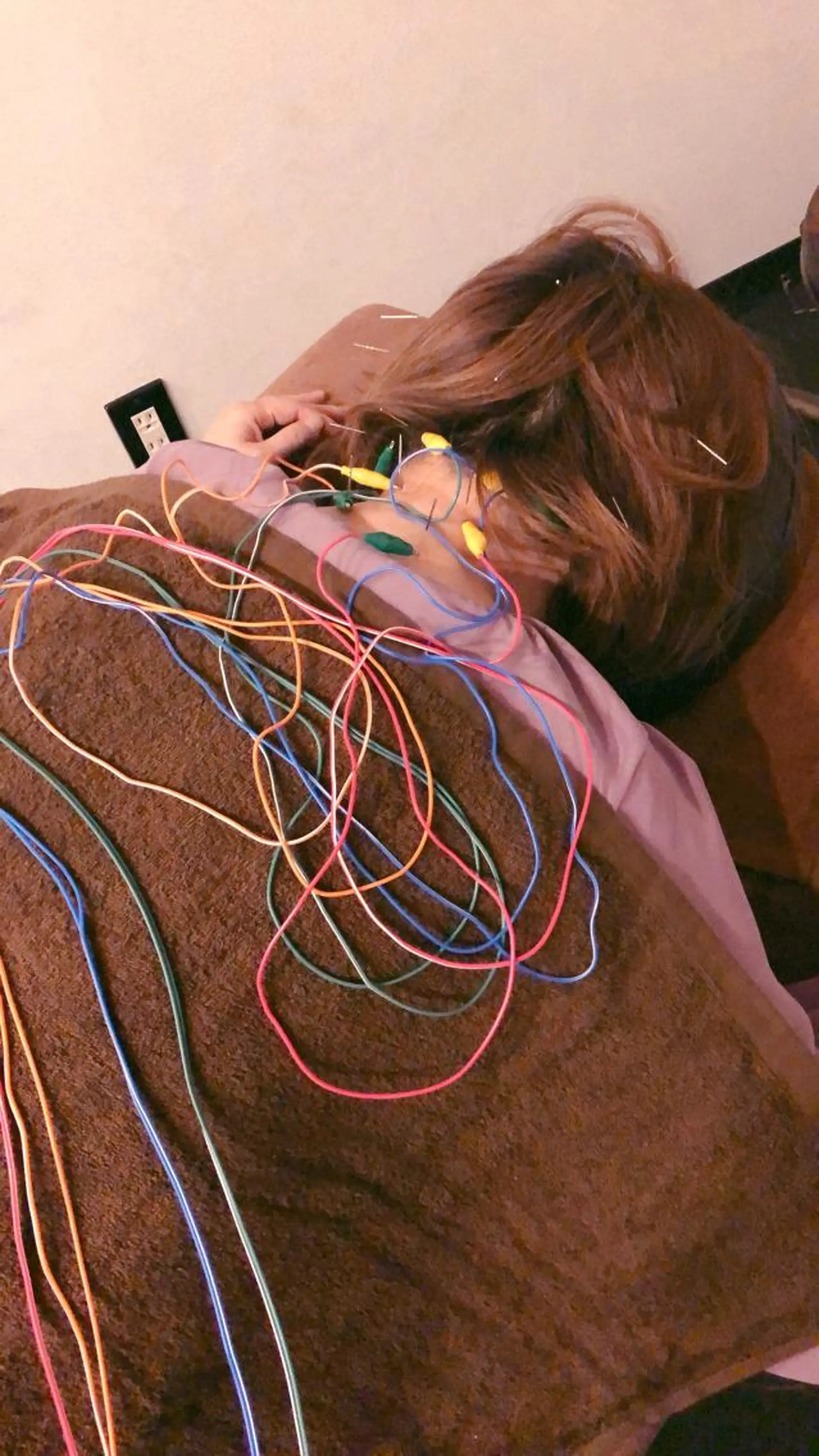 その他 美容鍼灸整体サロンBeauJu所属・小顔矯/美容鍼/鍼灸 BeauJuのその他イメージ