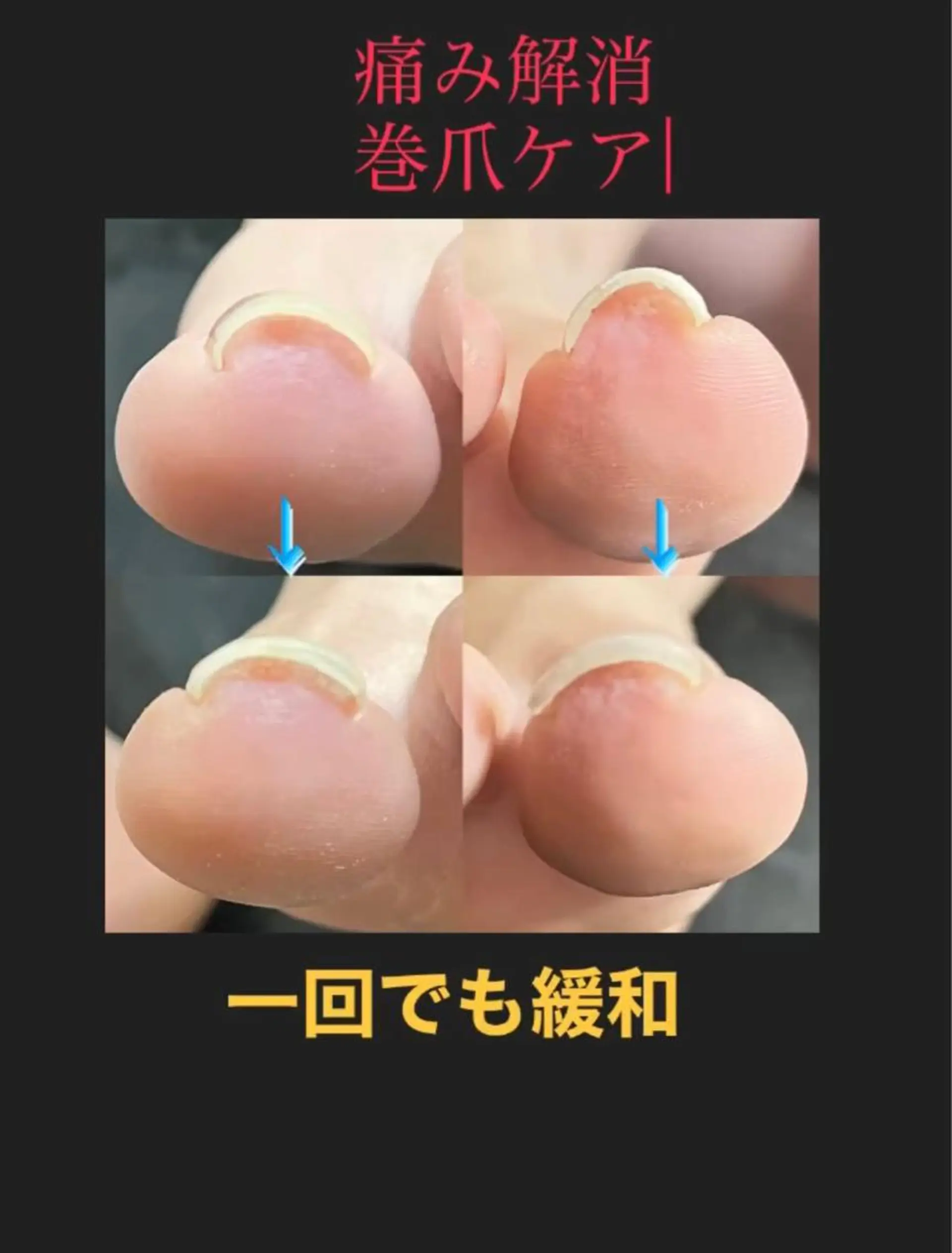 ネイル ネイルスペースR 小林のネイルデザイン