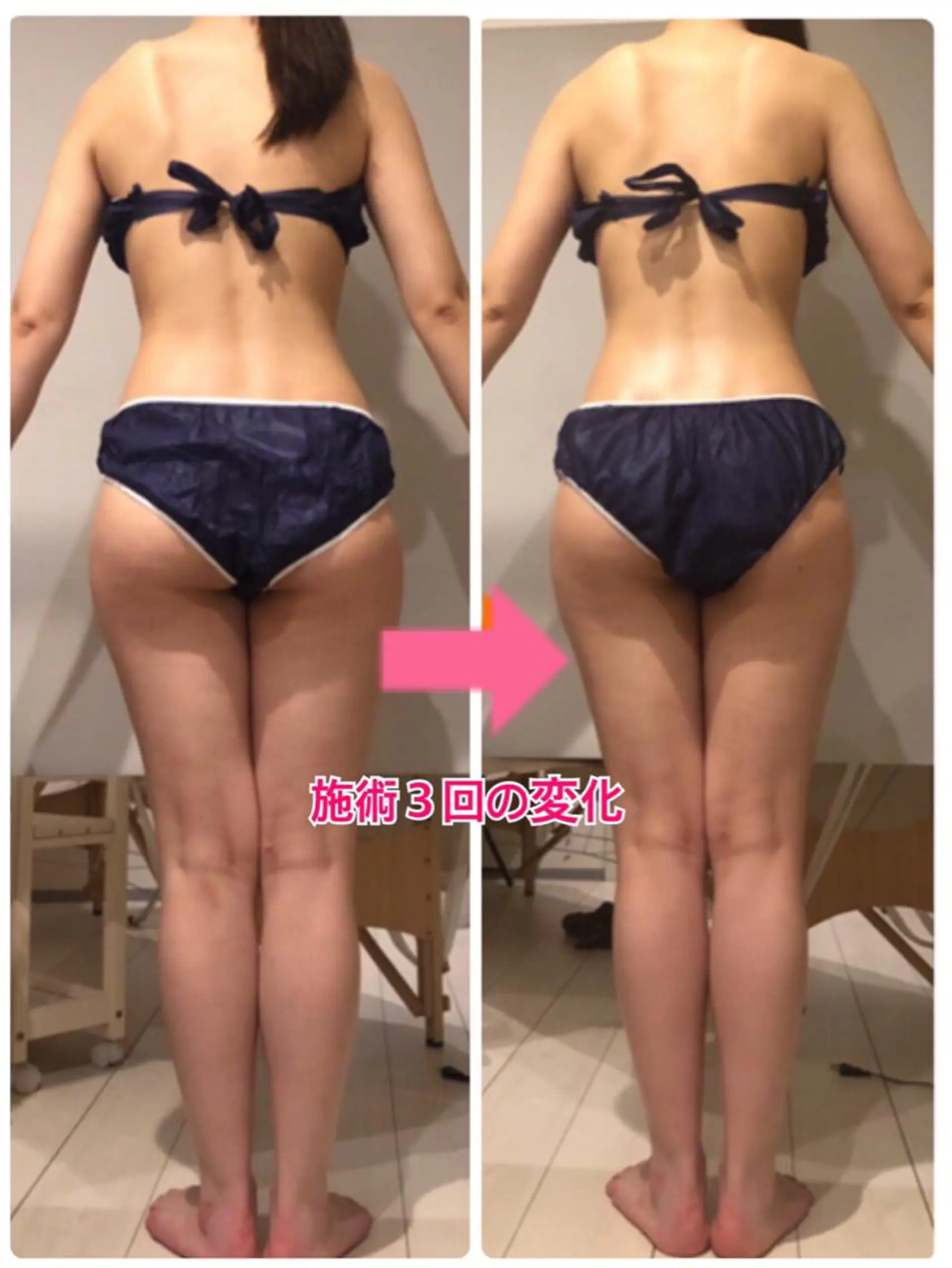 ロング カラー パーマ ヘアアレンジ メンズ キッズ ネイル マツエク・マツパ ‍痩身＆ボディ 結果出し🌟丹野のエステ・リラクイメージ