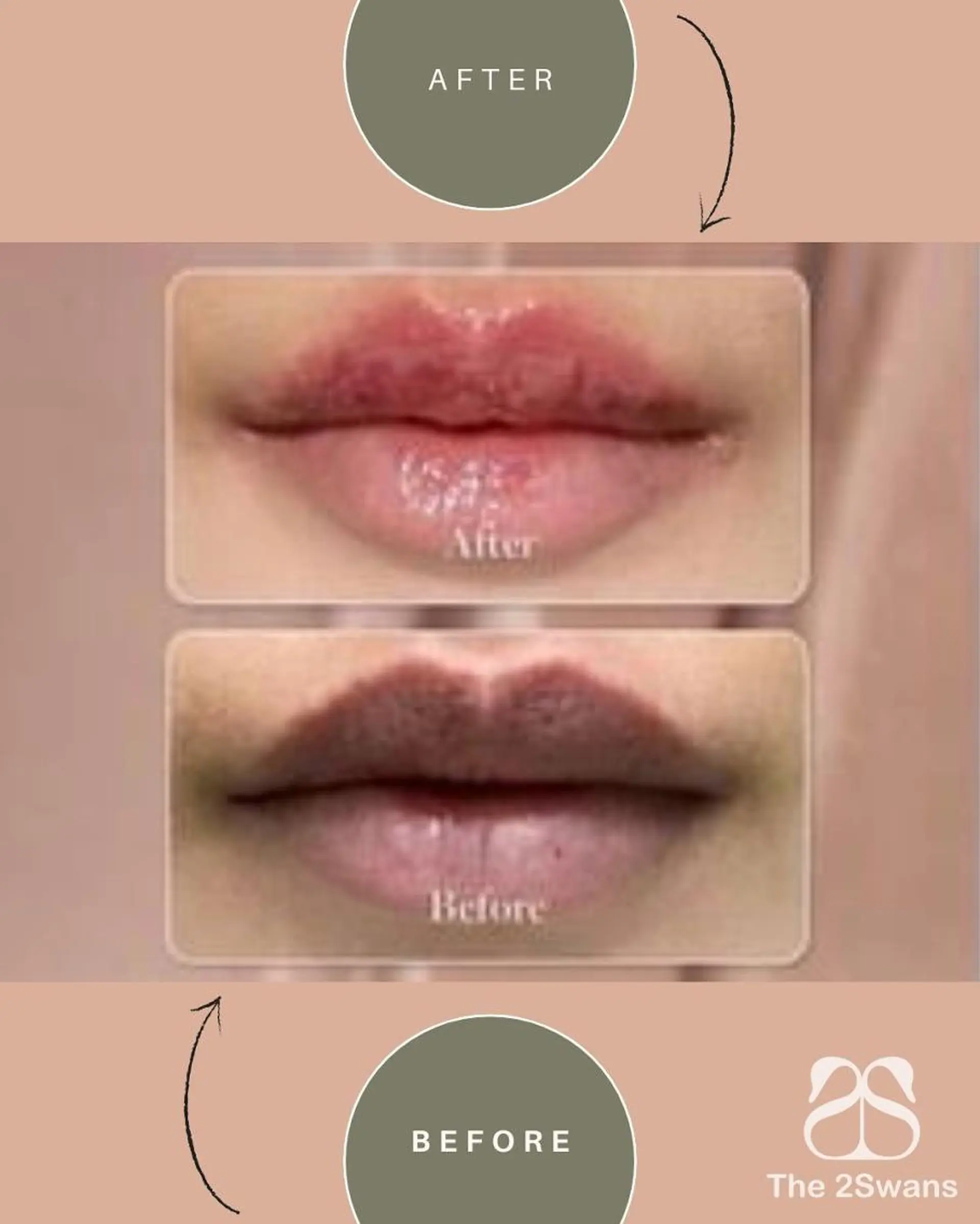 エステ The 2Swans フェイシャル サロンのエステ・リラクイメージ