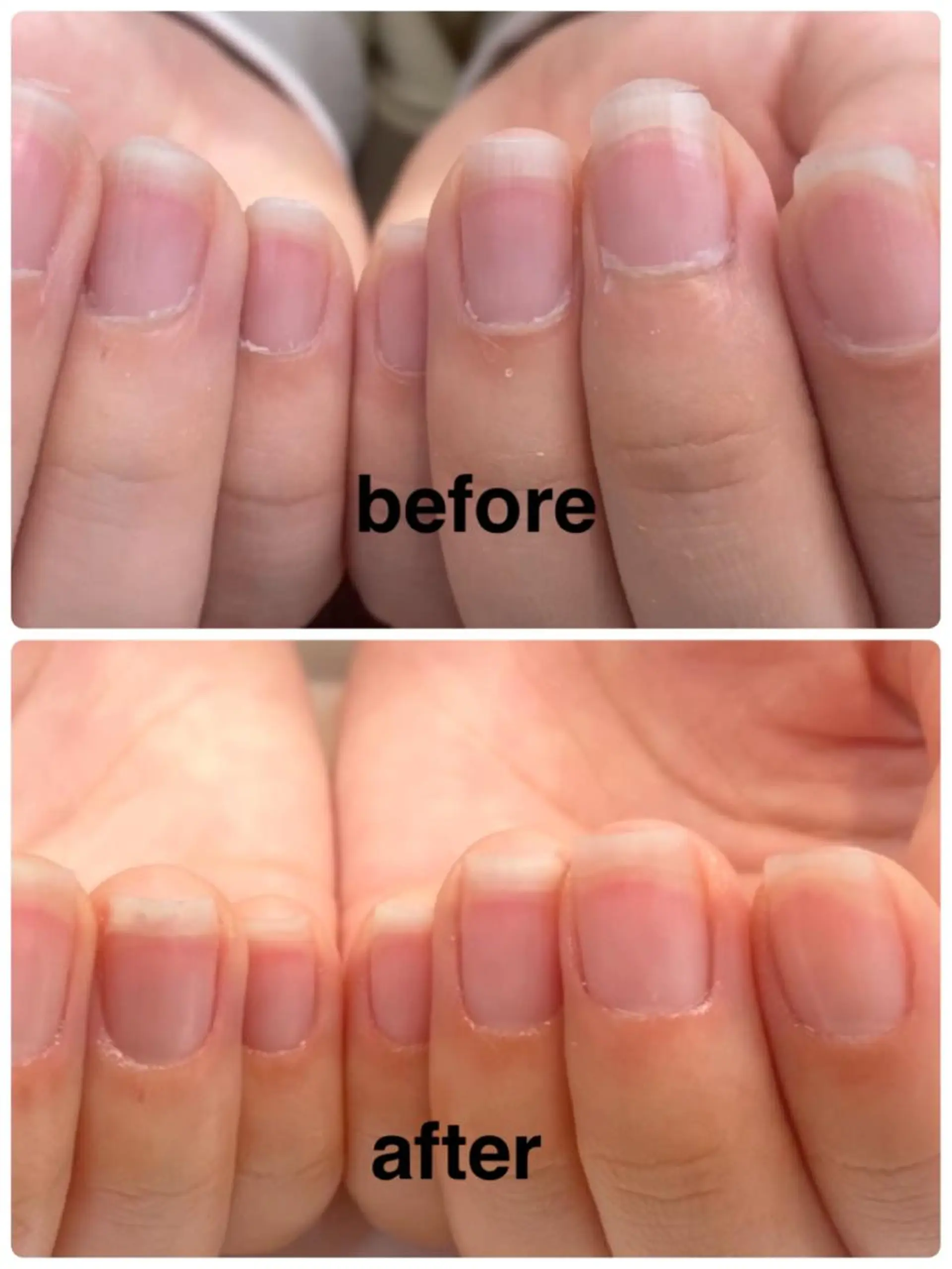 ネイル 竹本 恵美のネイルデザイン