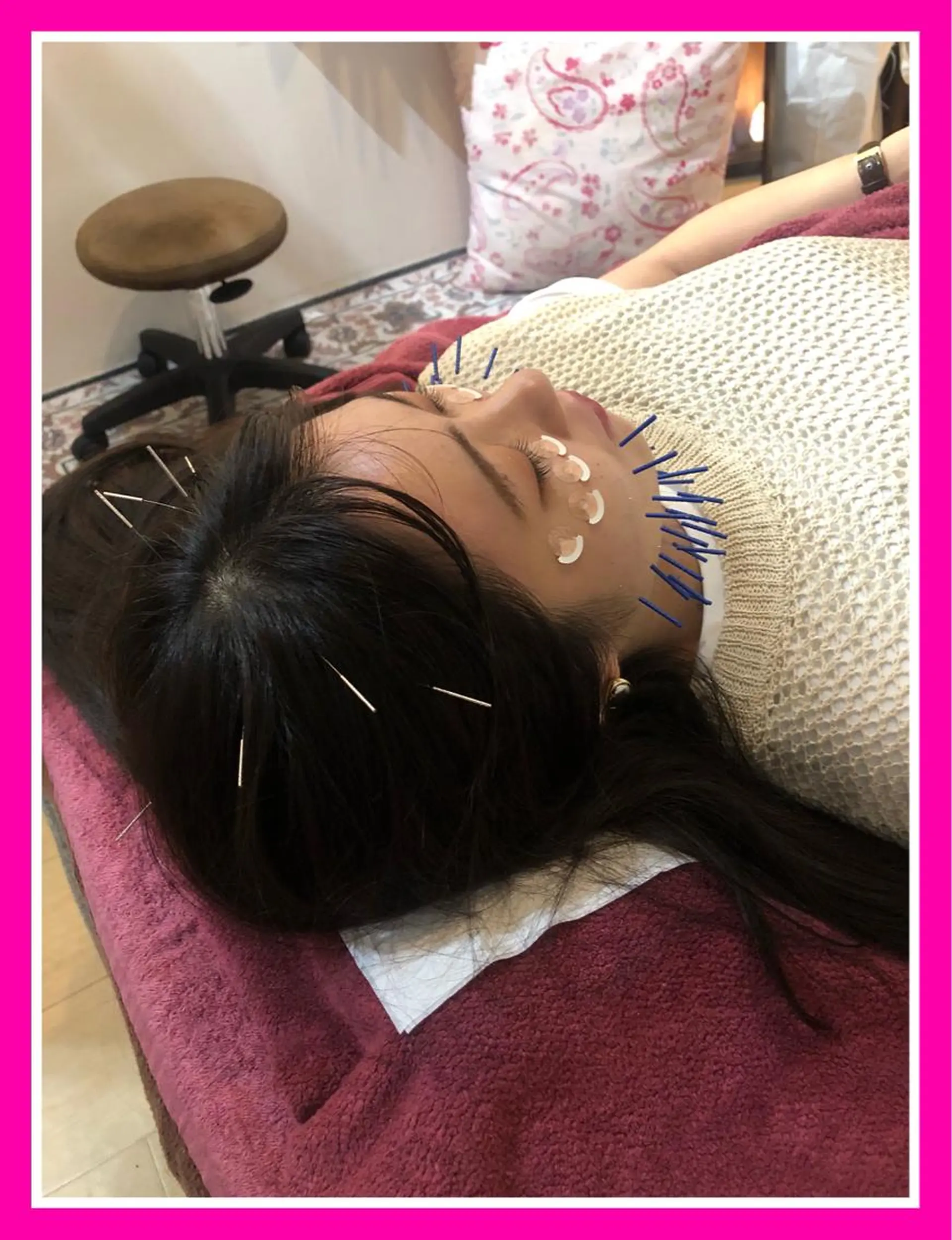 エステ リラク 美容鍼灸女性専用 りんご鍼灸治療院のその他イメージ