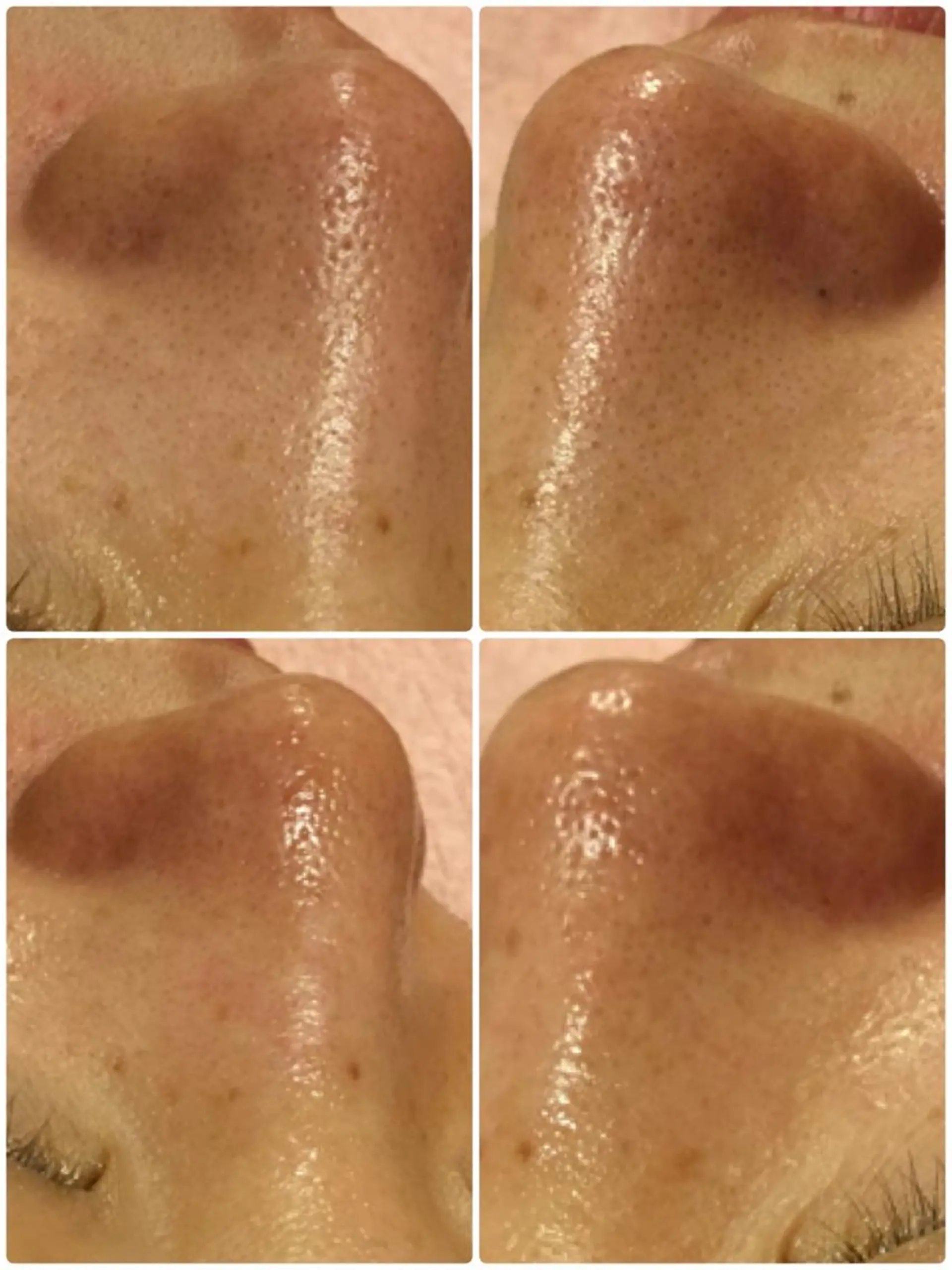 エステ Dione 立川店のエステ・リラクイメージ