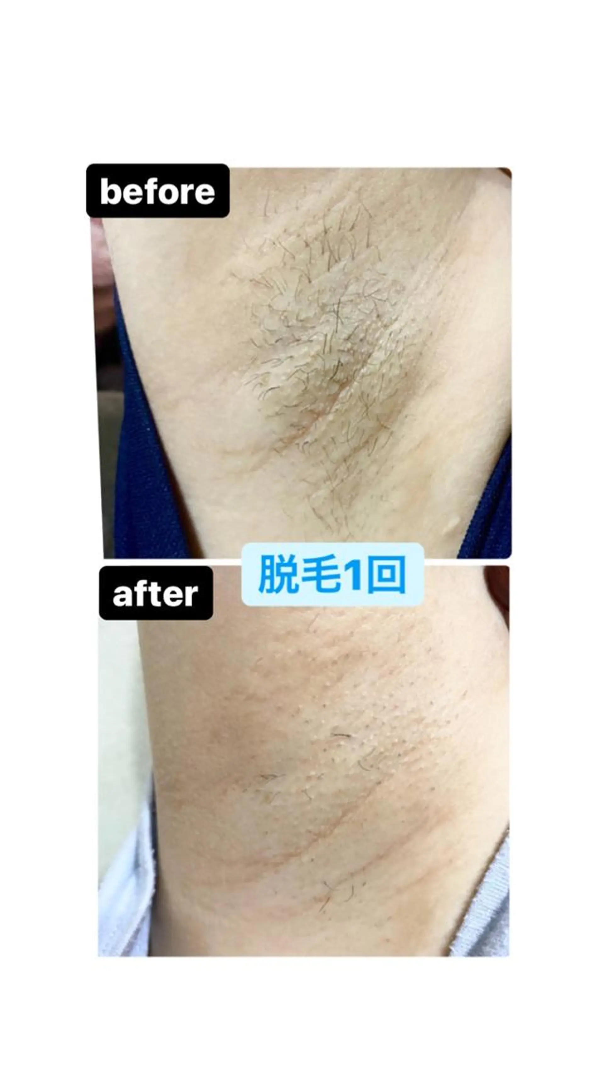 脱毛・エステサロン LuLuNのエステ・リラクイメージ