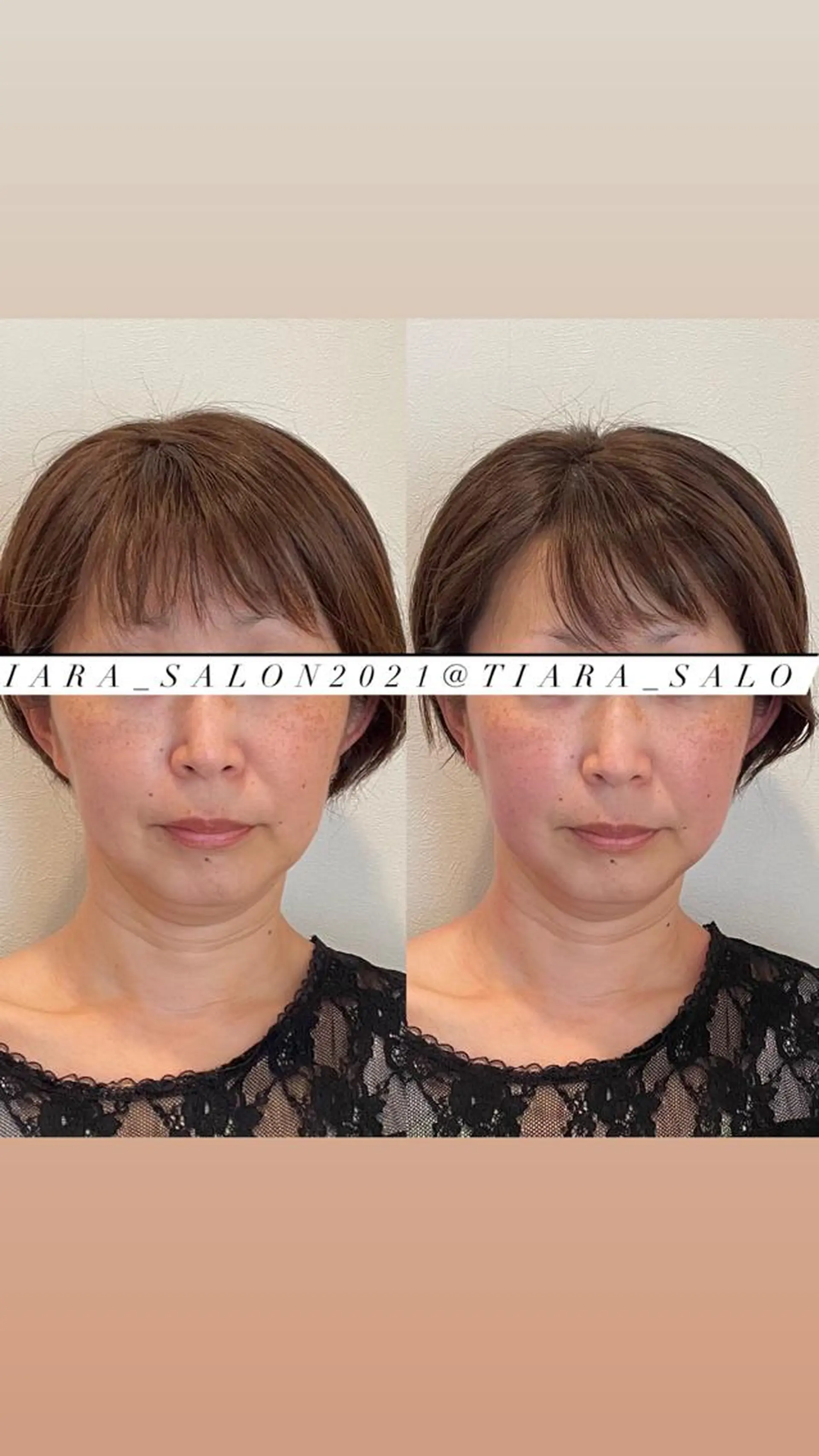 セミロング カラー パーマ ヘアアレンジ メンズ キッズ ネイル マツエク・マツパ アイブロウ 美容鍼灸サロン　TIARA所属・鍼灸サロン TIARA　美容鍼のエステ・リラクイメージ