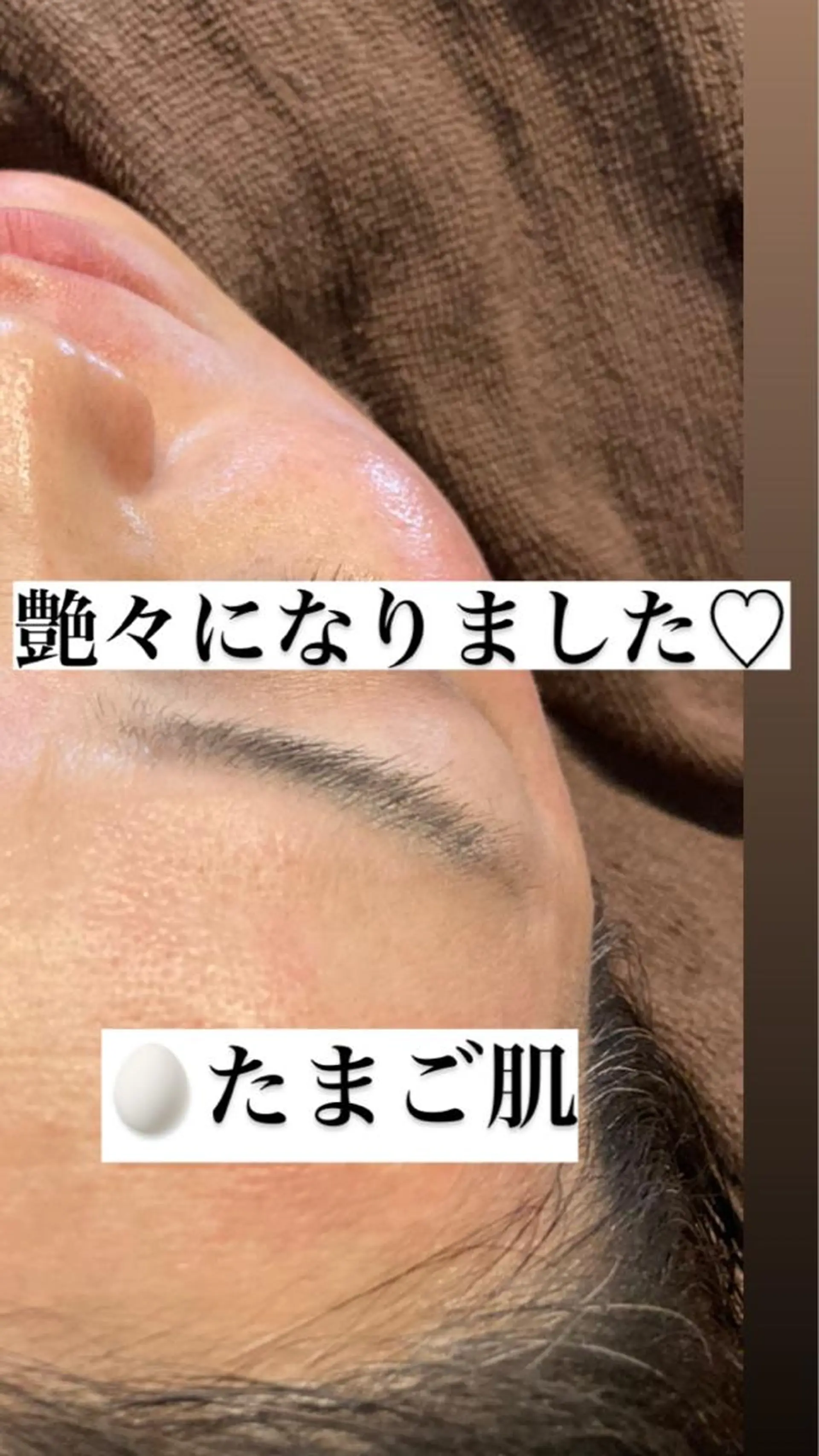 エステ 産毛専門店 Bittoのエステ・リラクイメージ