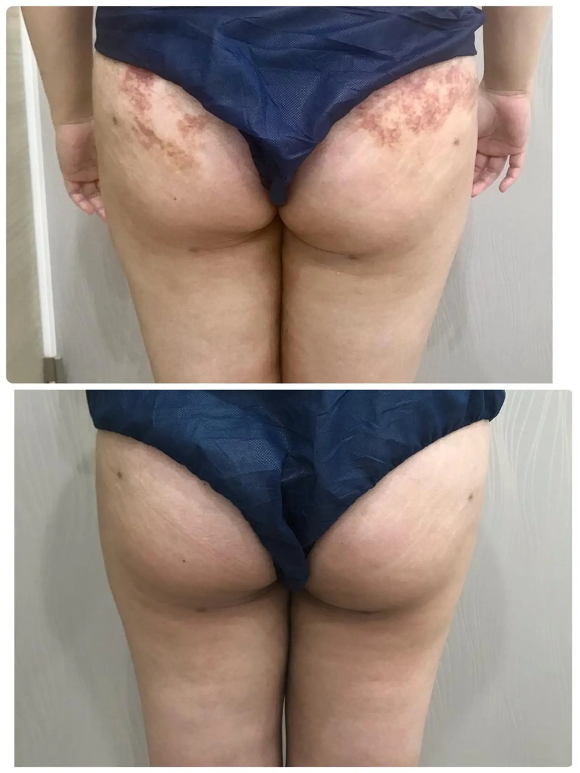 エステティックサロン ベルネのエステ・リラクイメージ