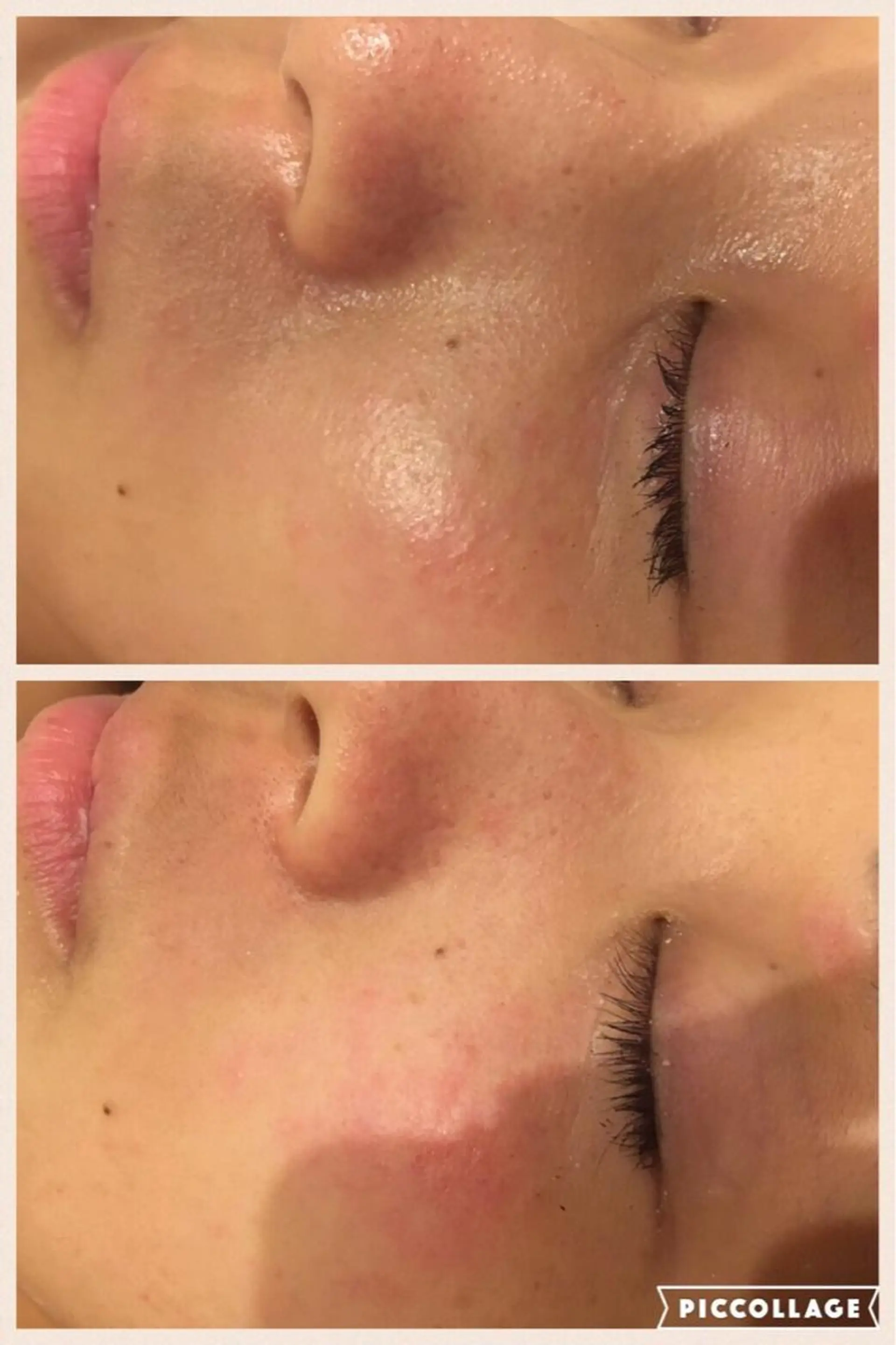 メンズ 金の糸脱毛 産毛ケア専門のエステ・リラクイメージ