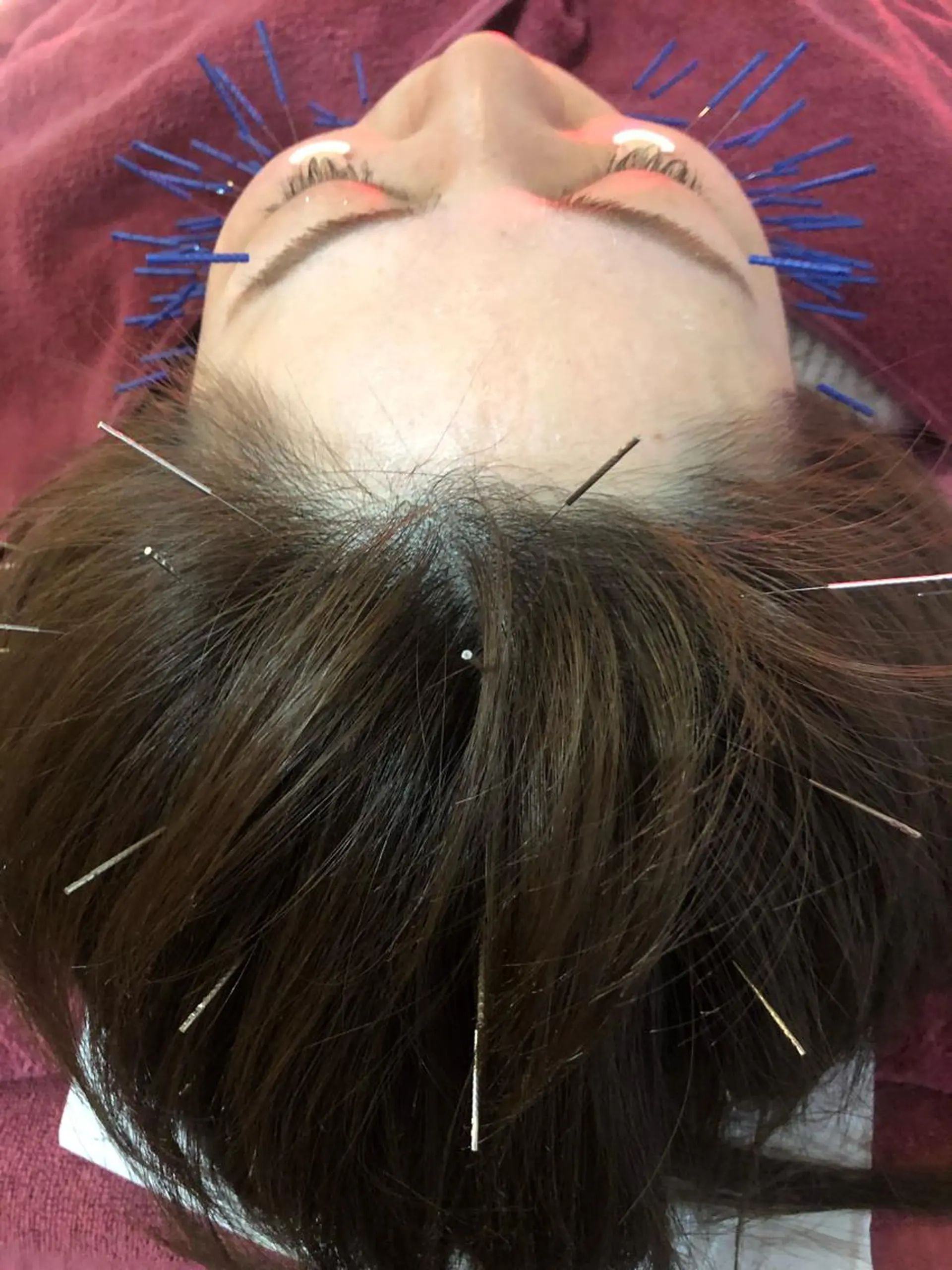 エステ リラク 美容鍼灸女性専用 りんご鍼灸治療院のその他イメージ