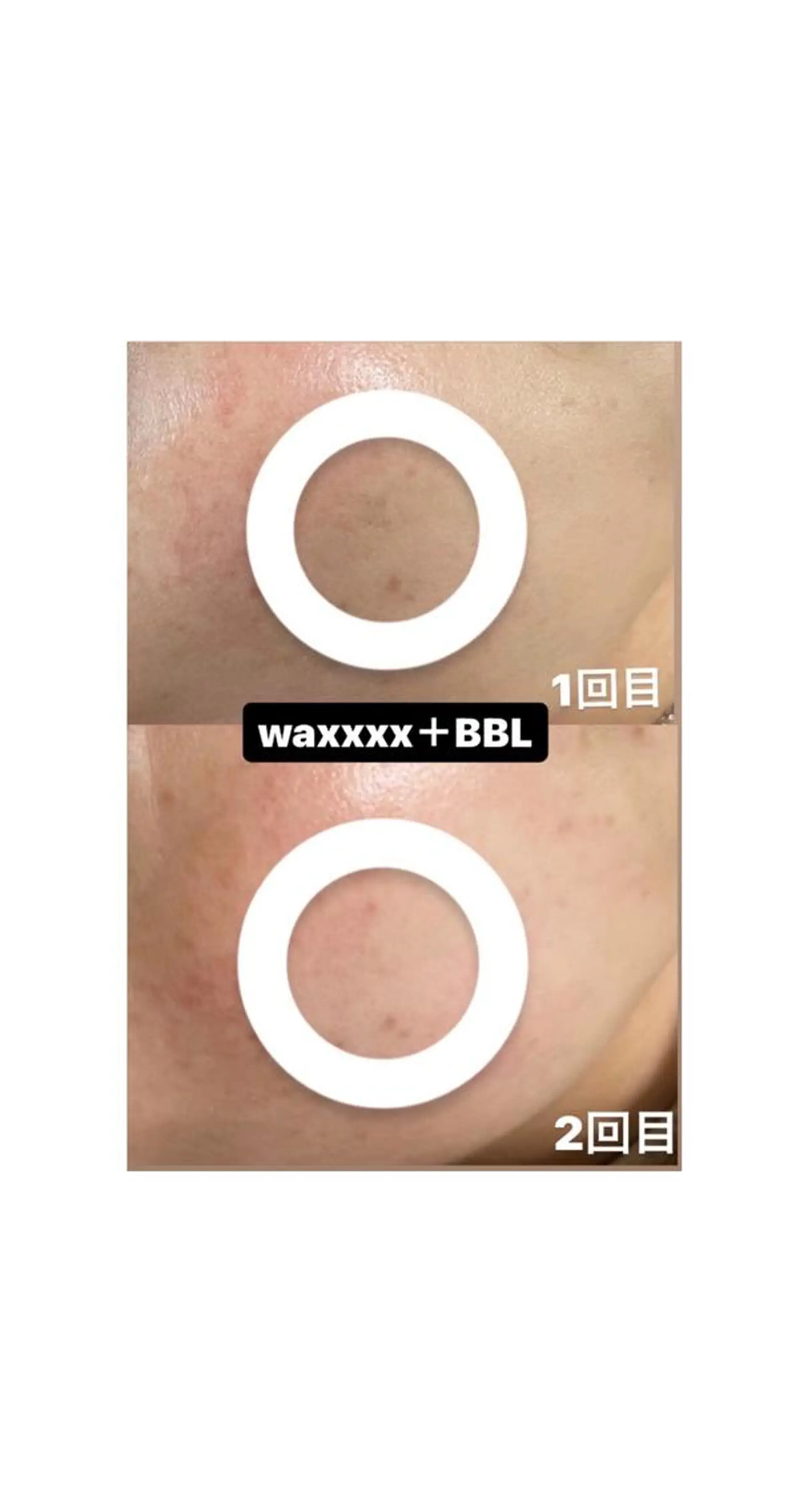 脱毛 Epina 千葉店 【エピナ】のエステ・リラクイメージ