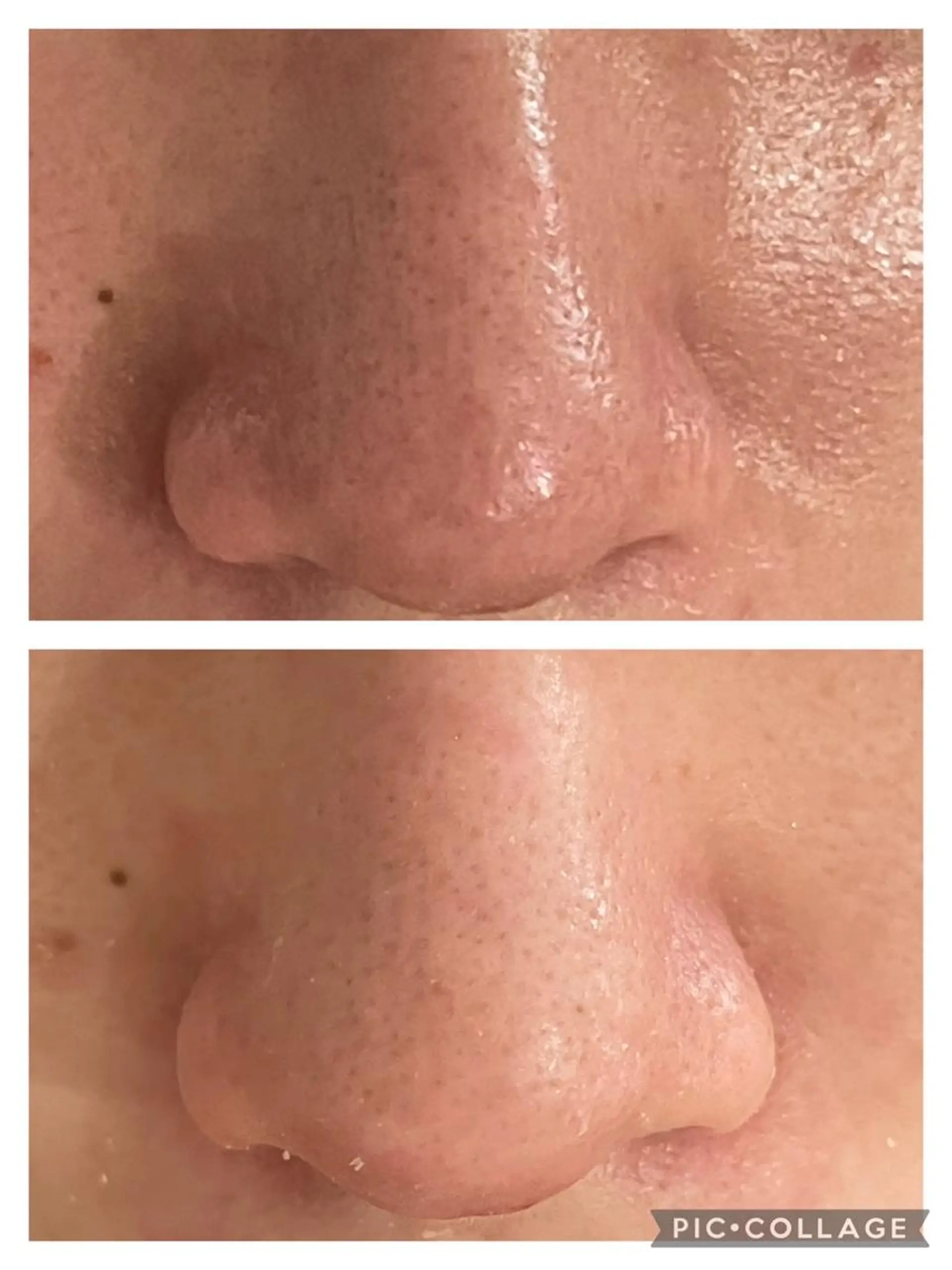 セミロング カラー パーマ ヘアアレンジ メンズ キッズ ネイル マツエク・マツパ アイブロウ 3か月で肌革命👼 ニキビ専門店💫のエステ・リラクイメージ