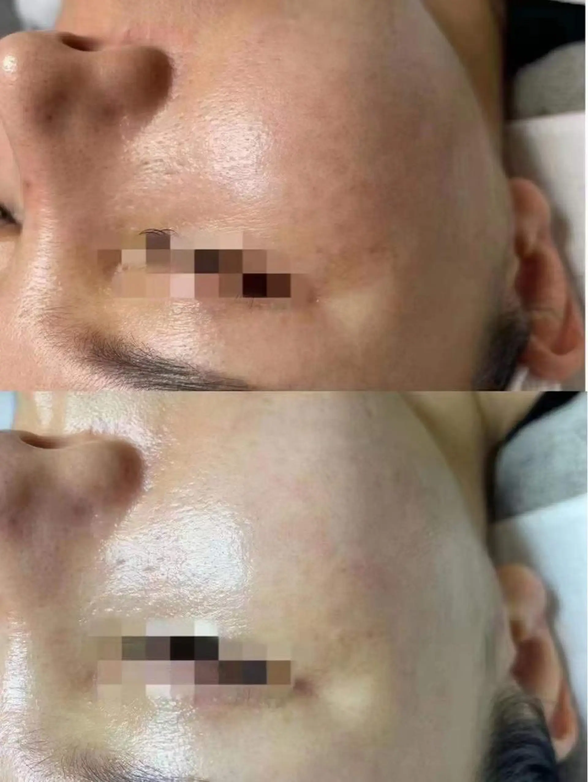 エステ aliaハーブ水光店 エステティシャン募集のエステ・リラクイメージ