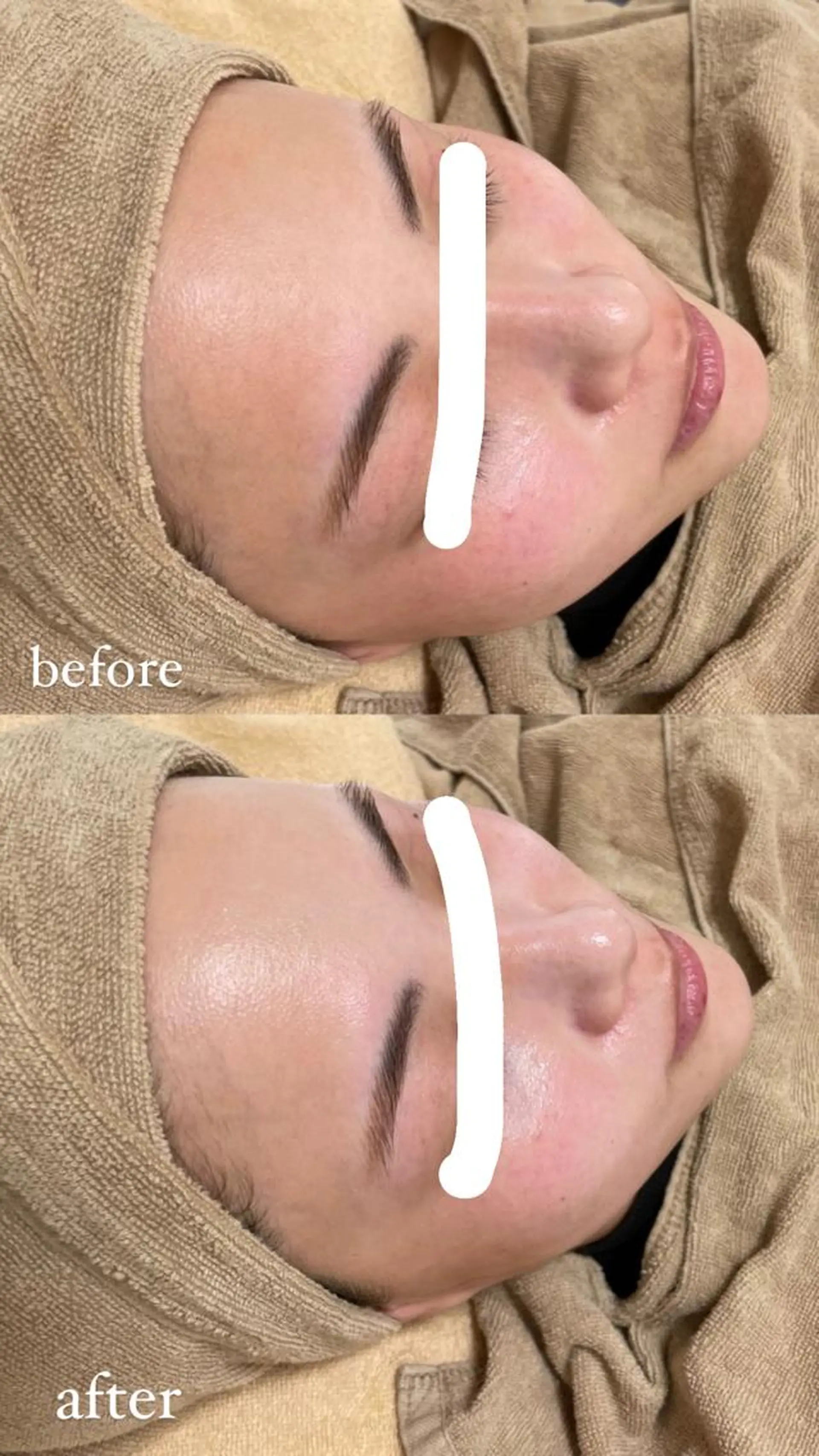 脱毛 エステサロン Mi-mi.iのエステ・リラクイメージ