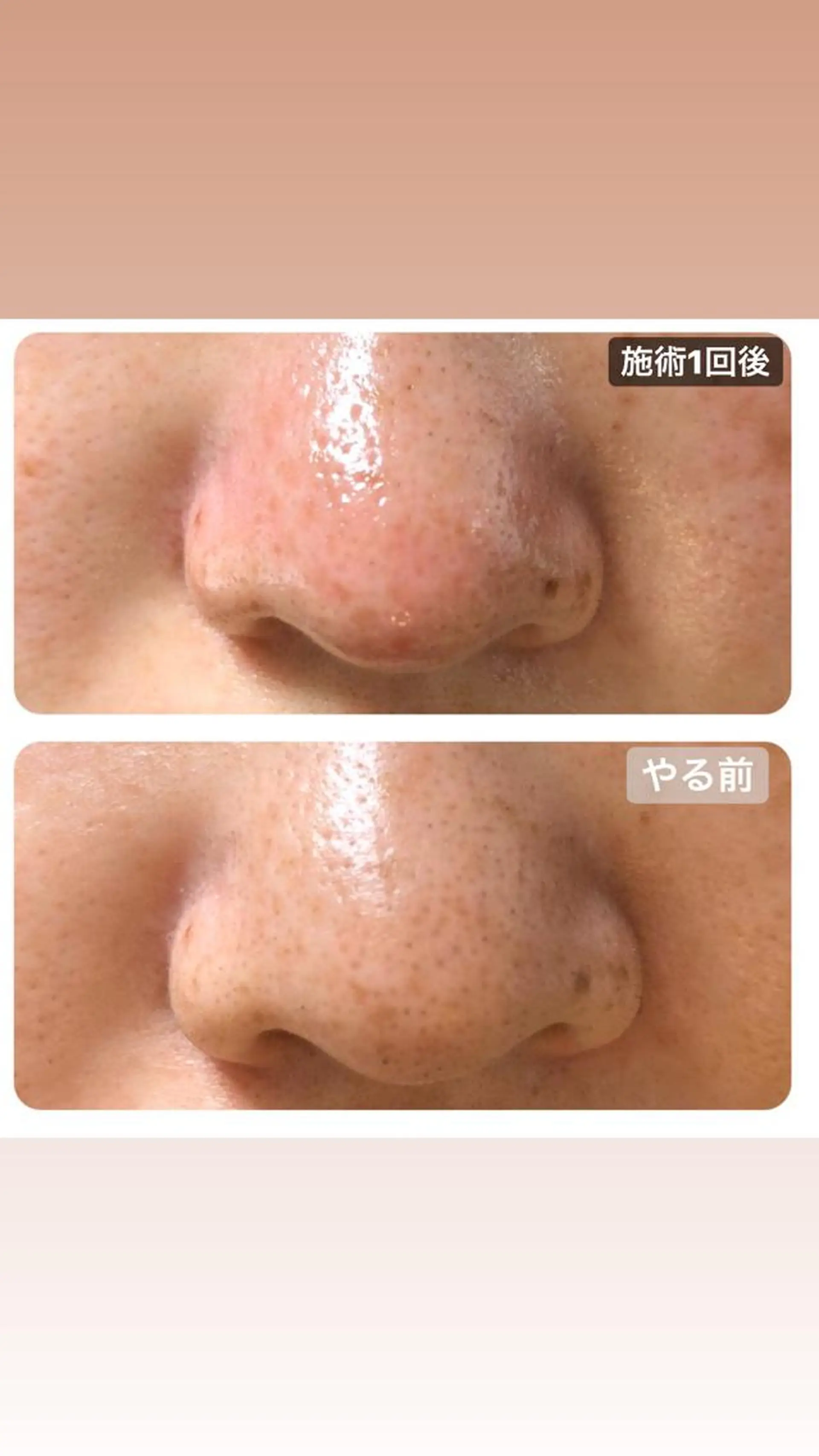 エステ i'llbe イルビーのエステ・リラクイメージ