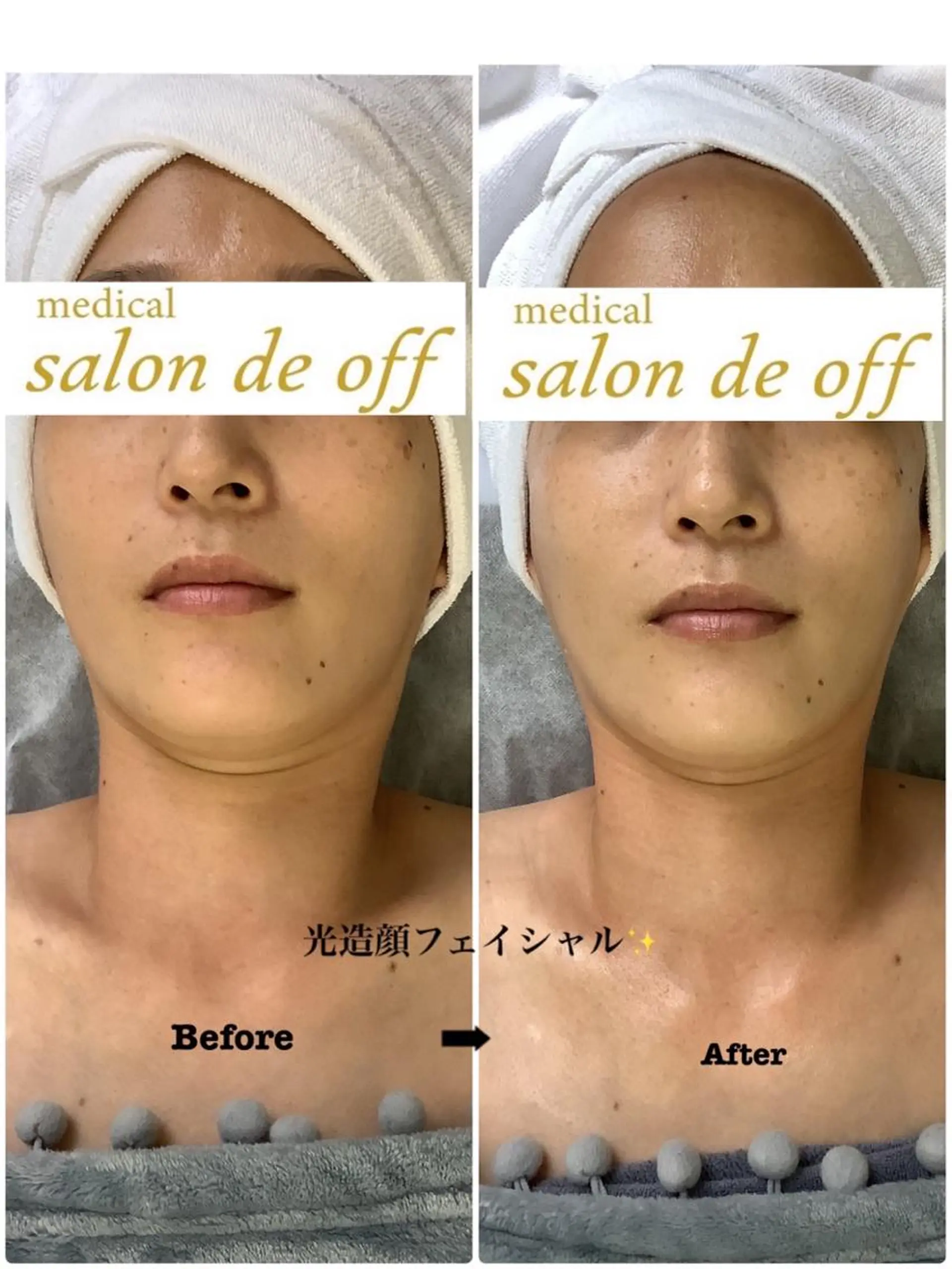 エステ リラク 🩵Tatsumi Kana🩵のエステ・リラクイメージ