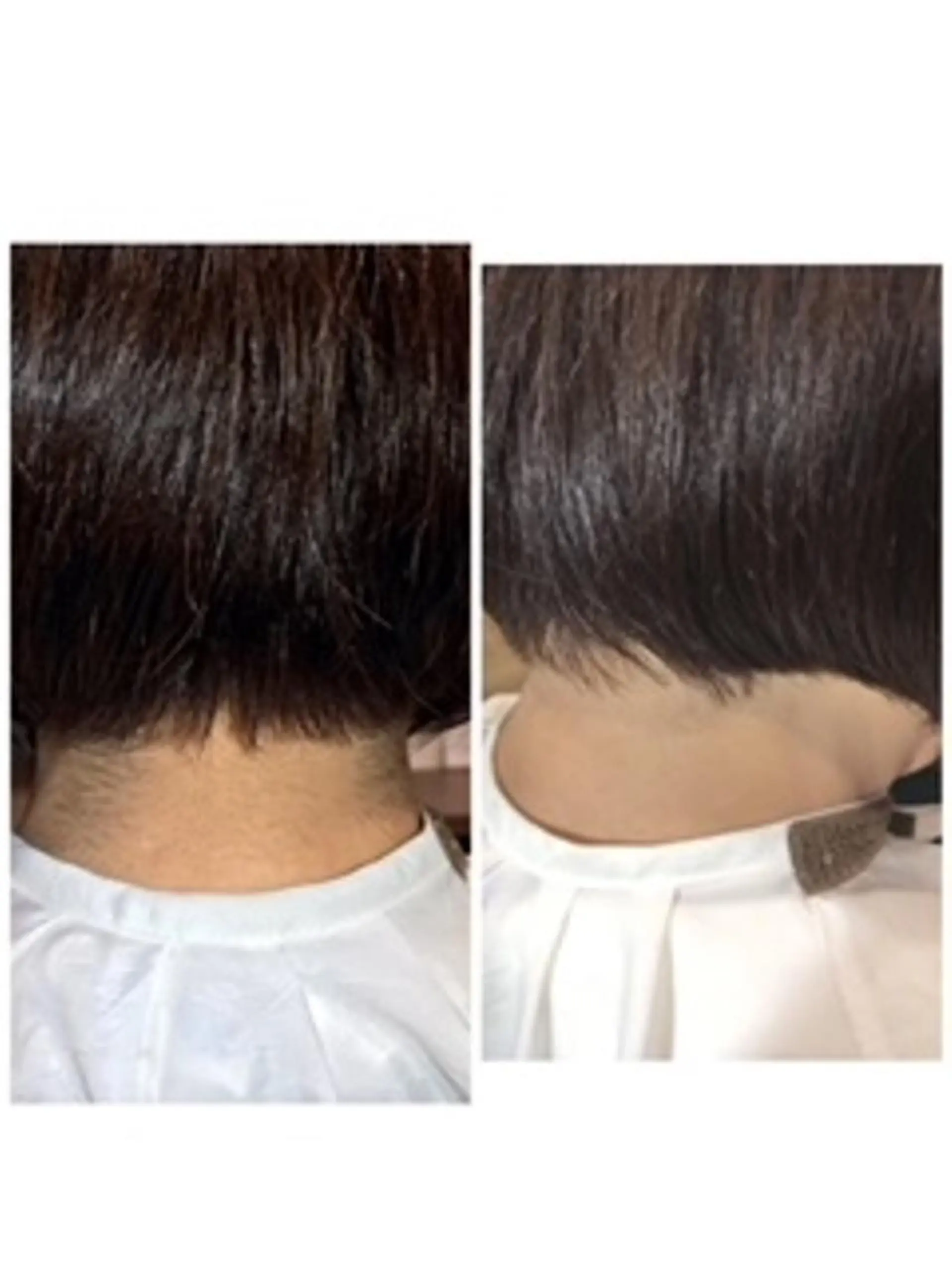 脱毛 Lien オーナー　山口智嘉のエステ・リラクイメージ