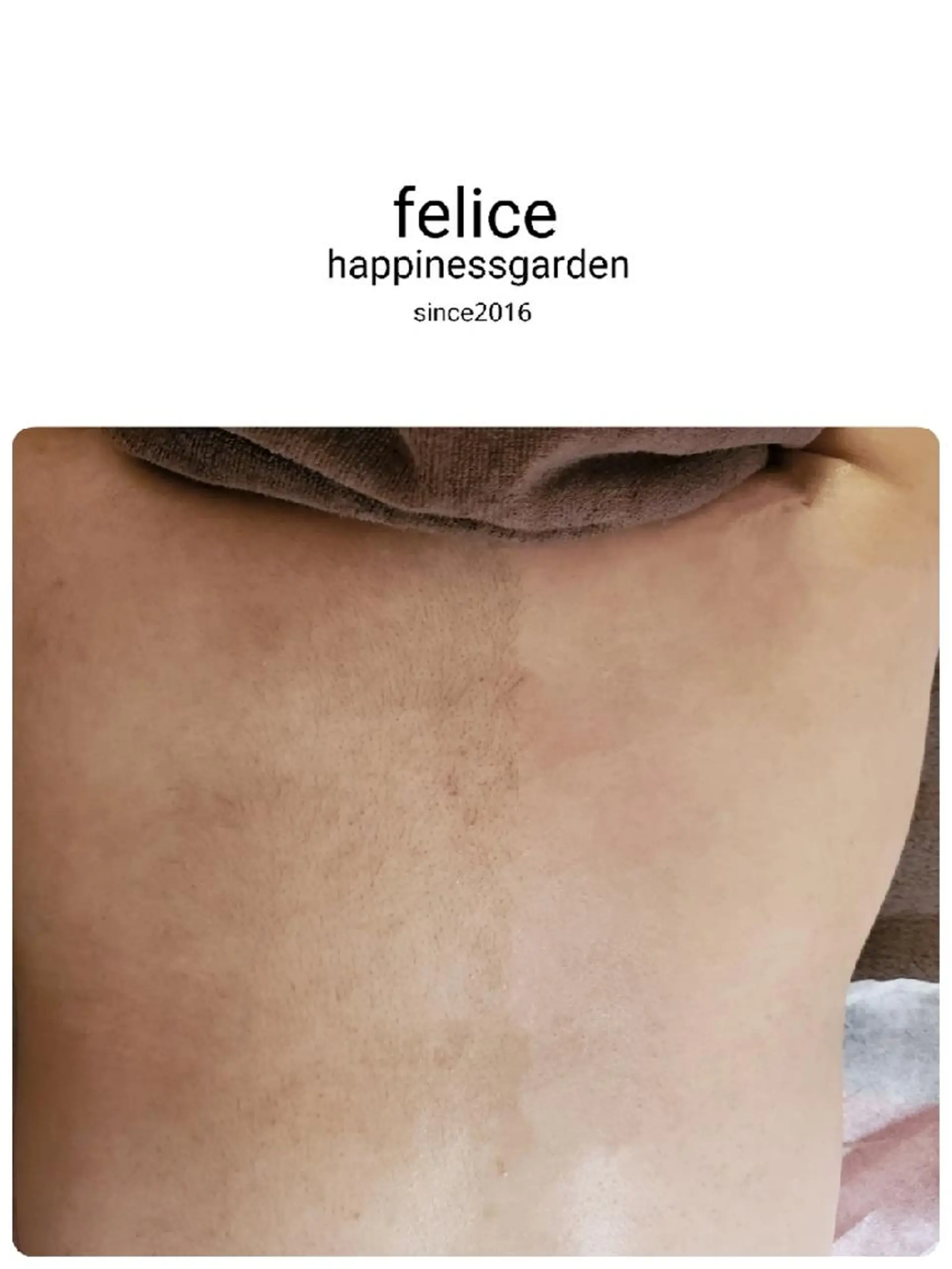 脱毛 フェリーチェ 心斎橋のエステ・リラクイメージ