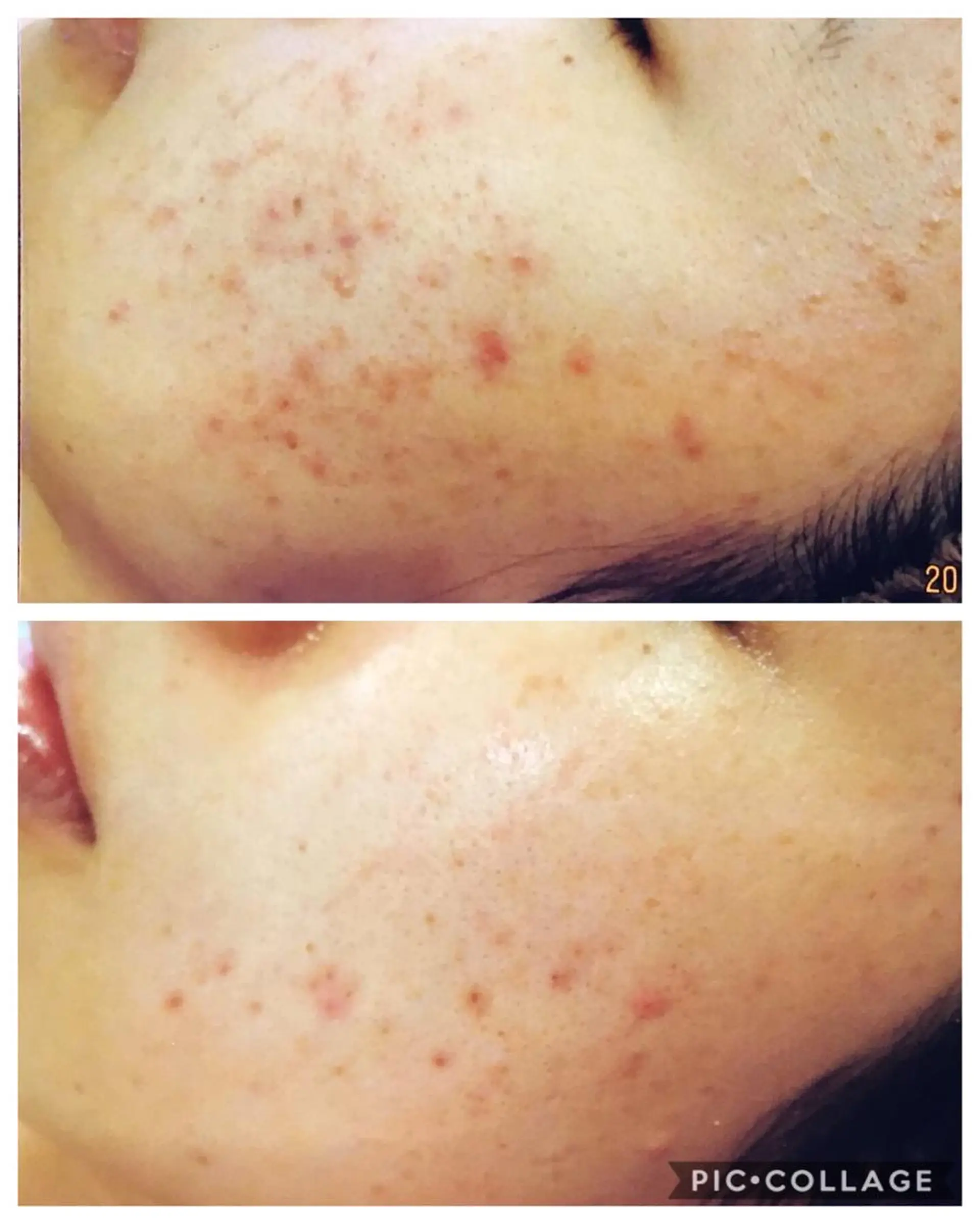 ジョリ   ヴェール 山口のマツエク・マツパデザイン