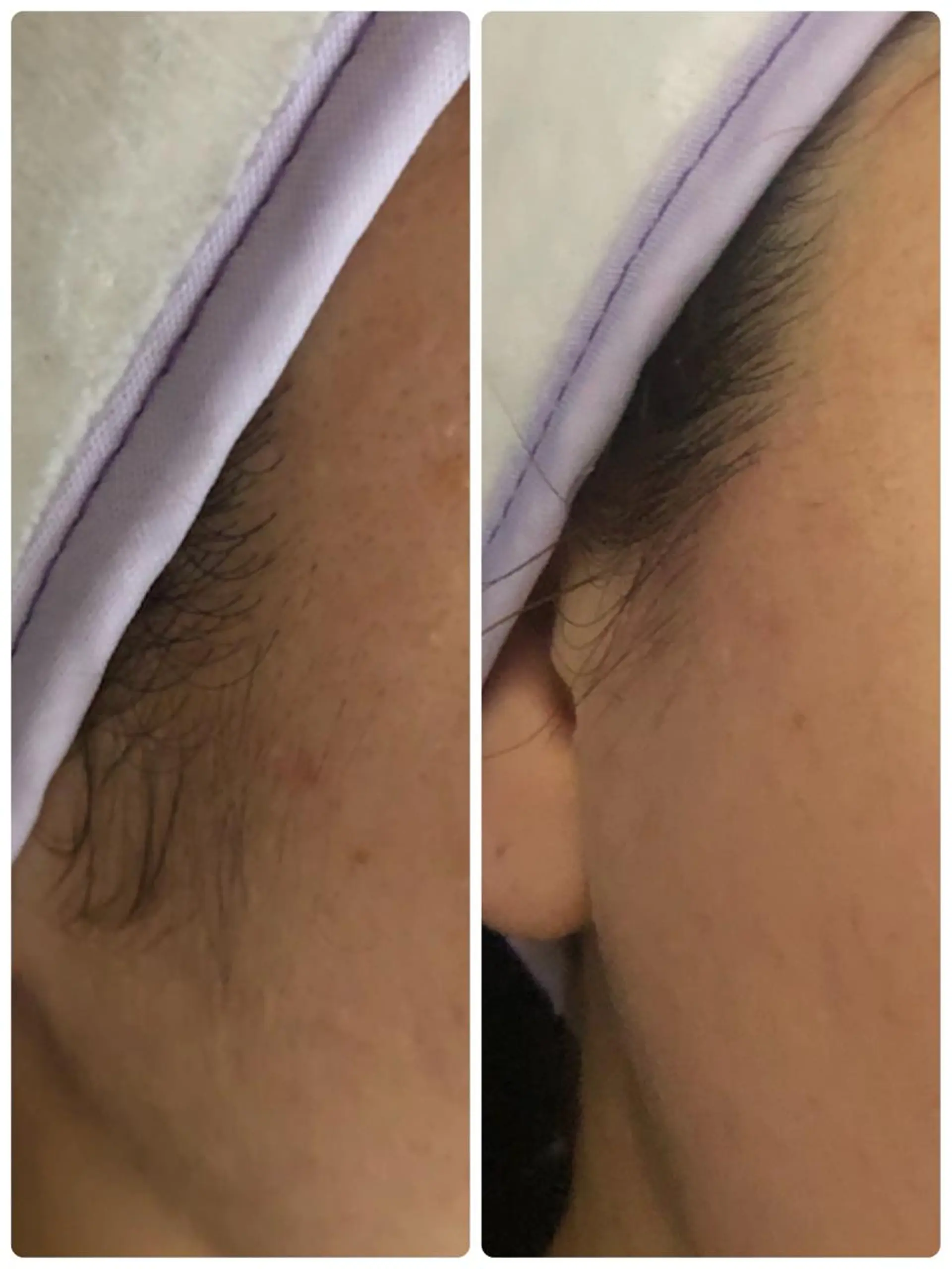 脱毛 宜野湾美肌脱毛fuu okinawaタイラのエステ・リラクイメージ