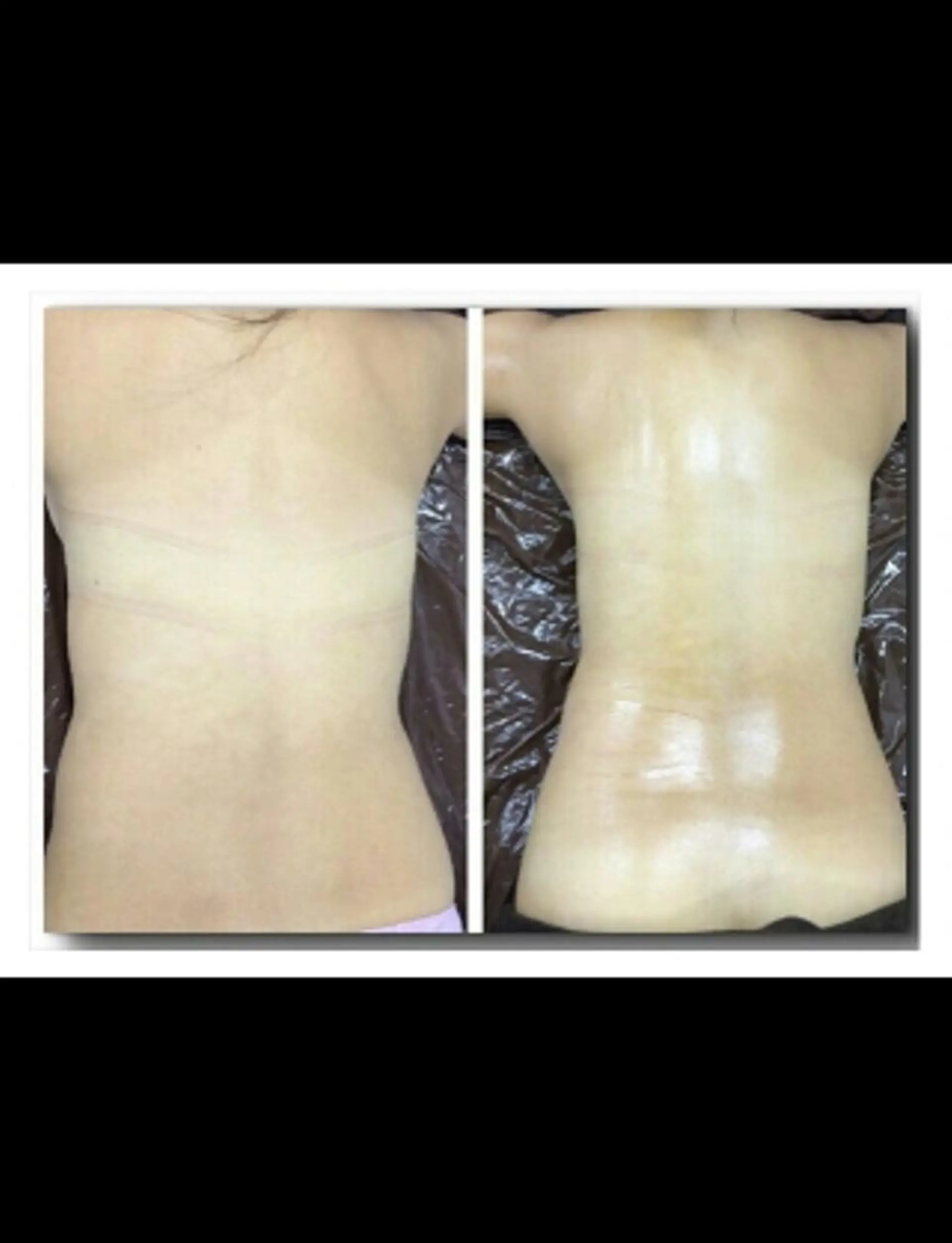 トータルビューティー CQのネイルデザイン