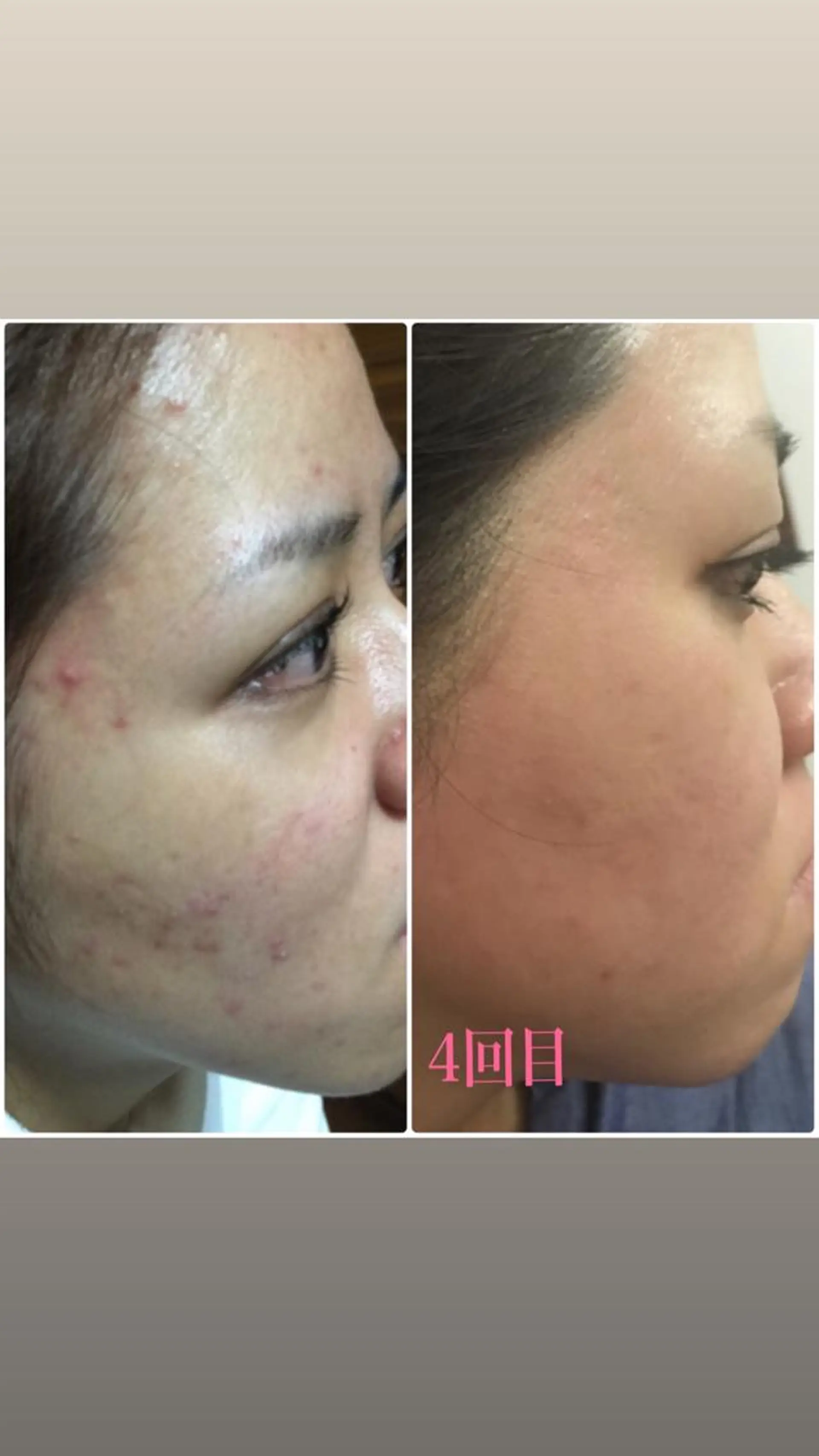 宜野湾美肌脱毛fuu okinawaタイラのエステ・リラクイメージ