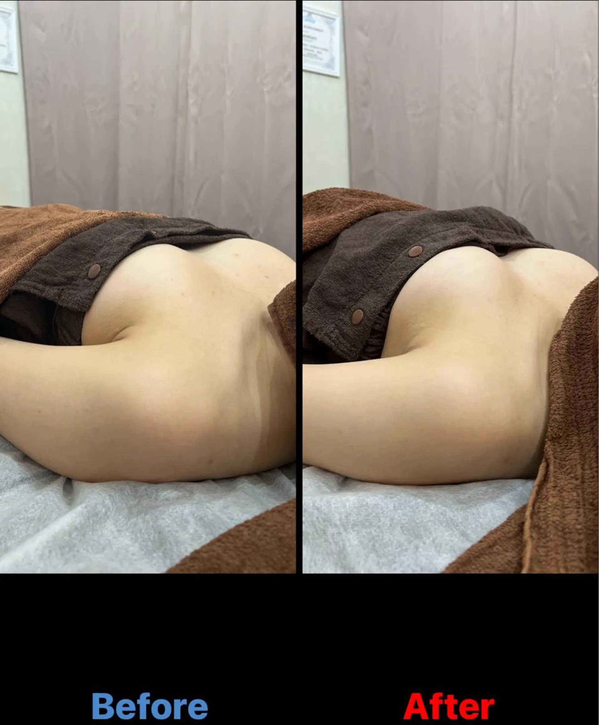 エステ 毛穴改善/脱毛 ネイル　川上久仁子のエステ・リラクイメージ