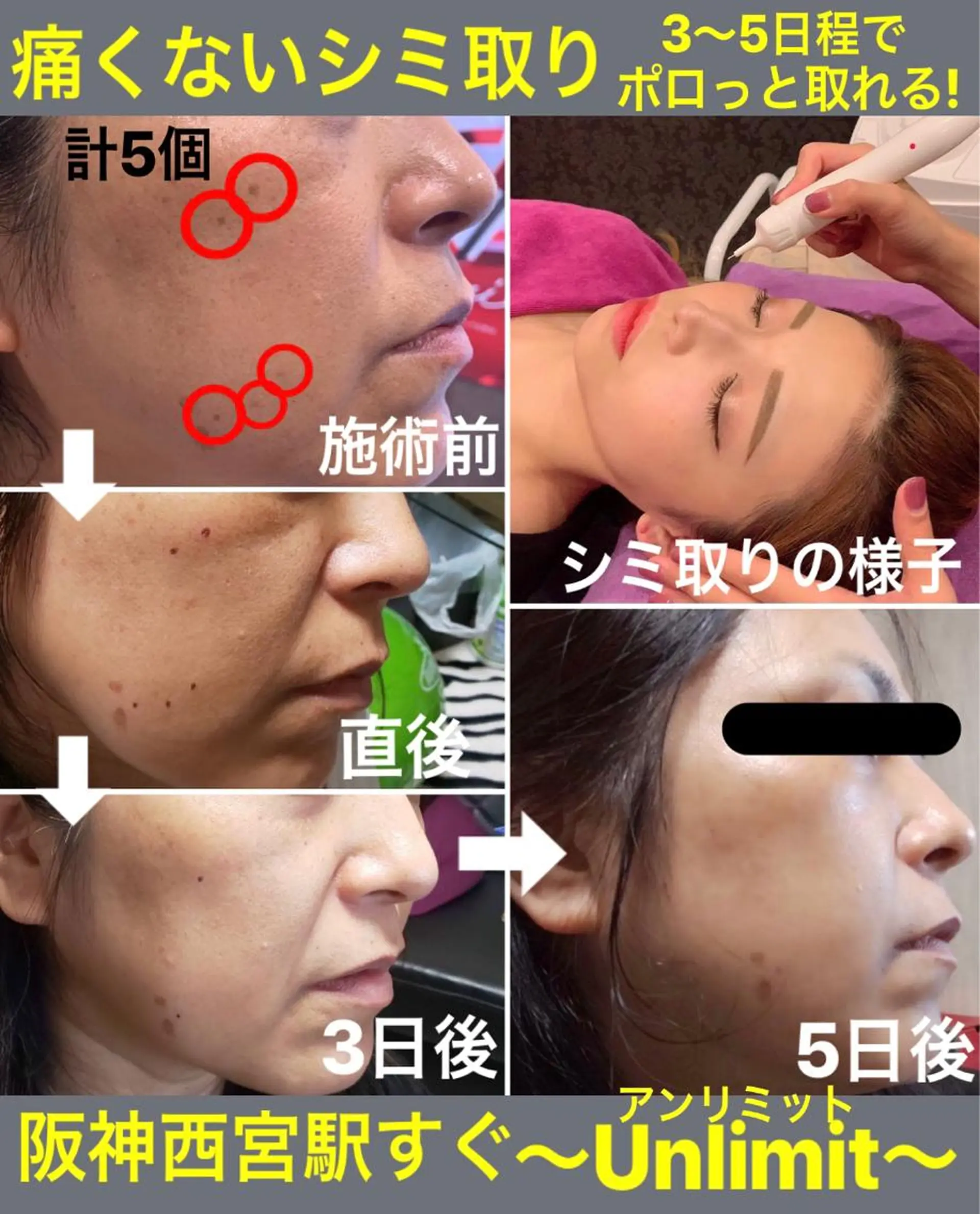 森谷 莉美のエステ・リラクイメージ