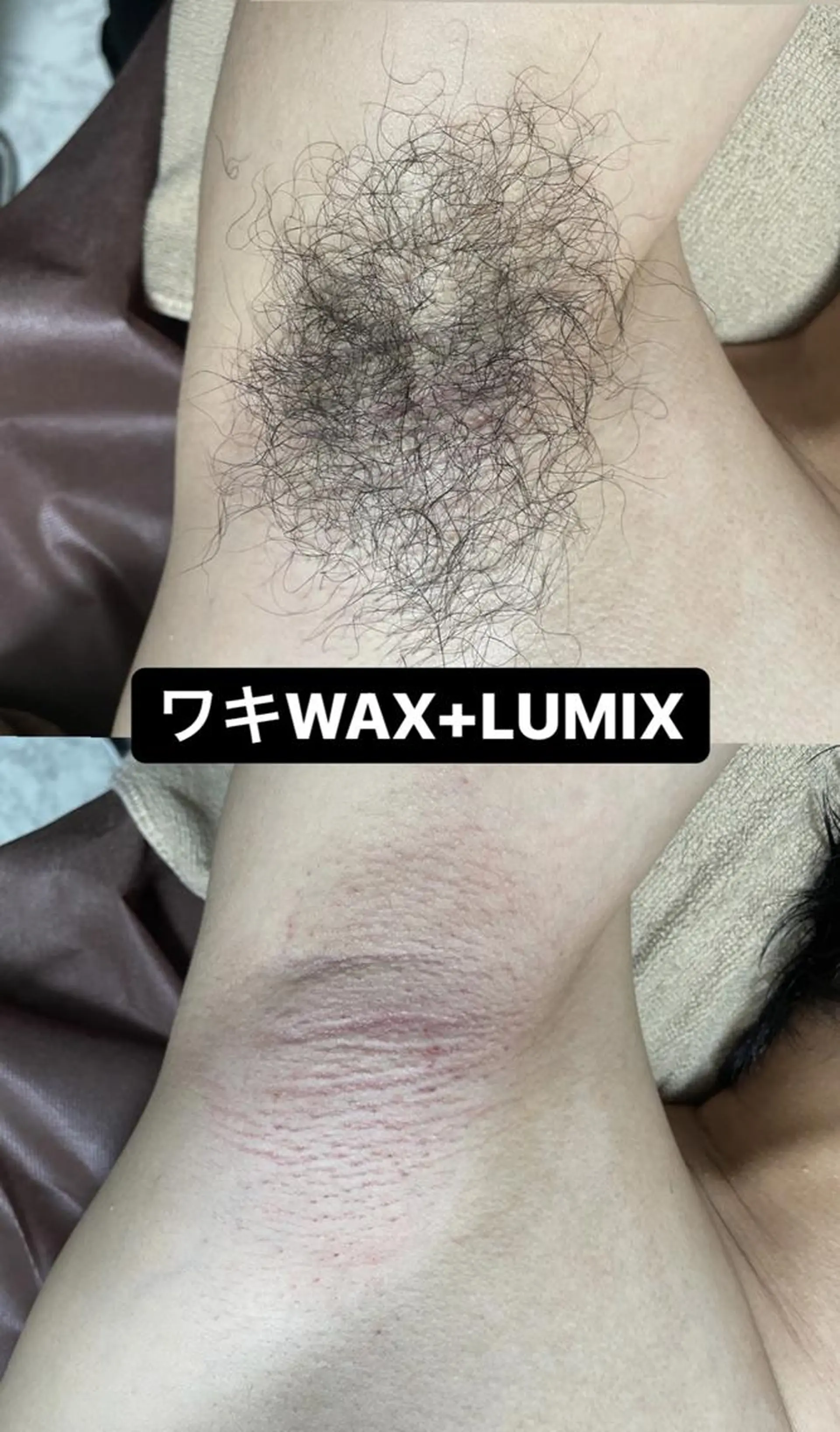 メンズ キッズ 脱毛 Epina 千葉店 【エピナ】のエステ・リラクイメージ