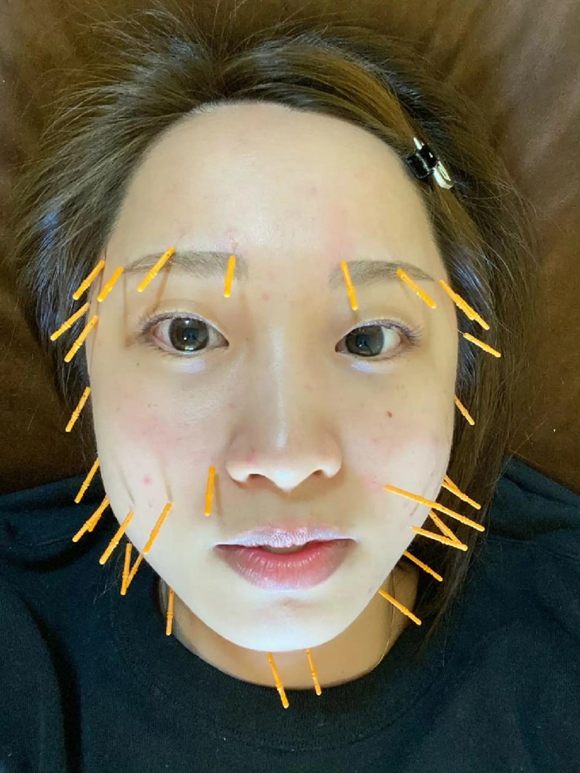 エステ リラク かかず美容鍼灸院所属・美容鍼×整体 かかずまさきのエステ・リラクイメージ