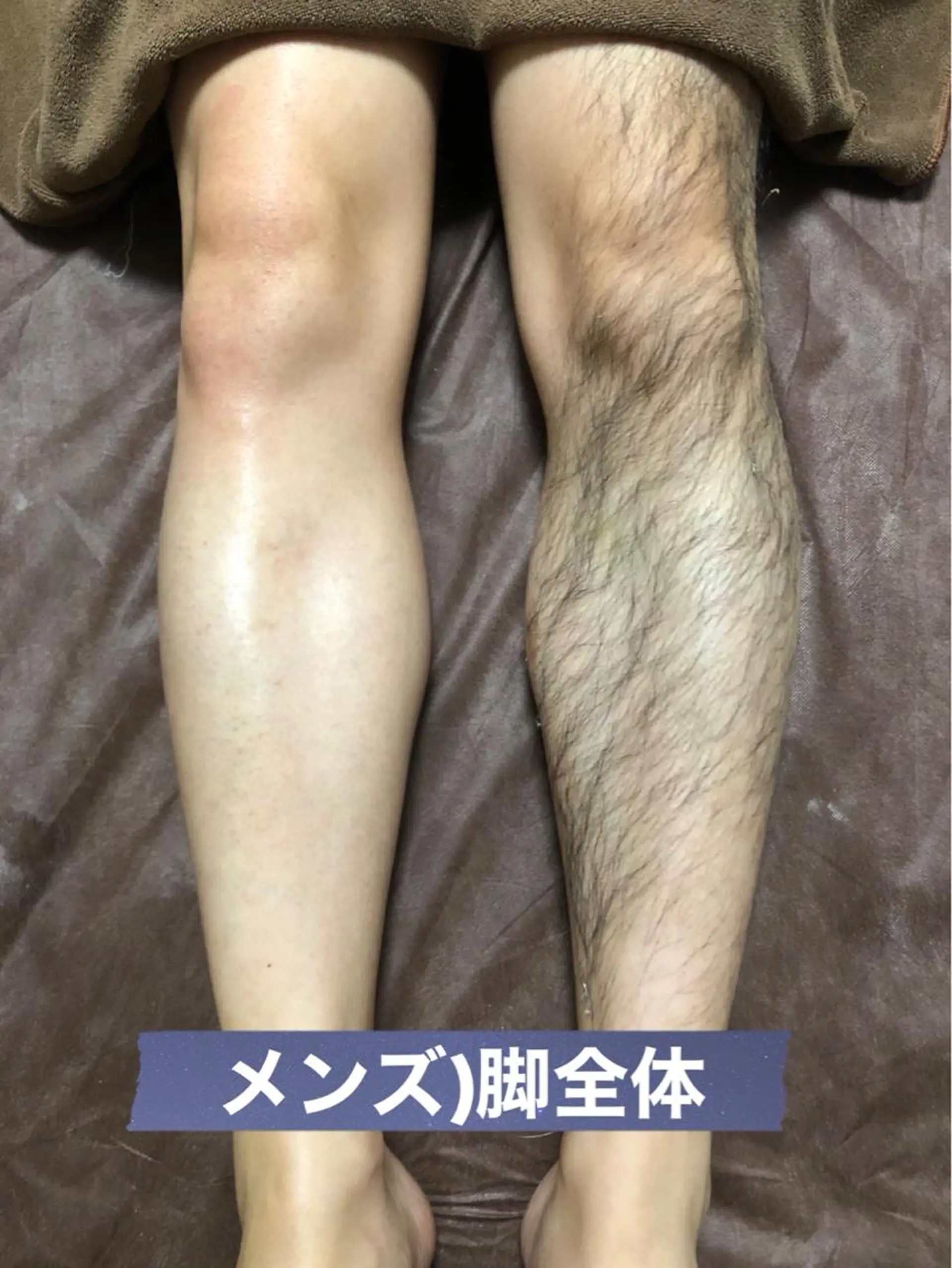 メンズ ブラジリアン☆WAX 🎖🌚YUKI🌚のエステ・リラクイメージ