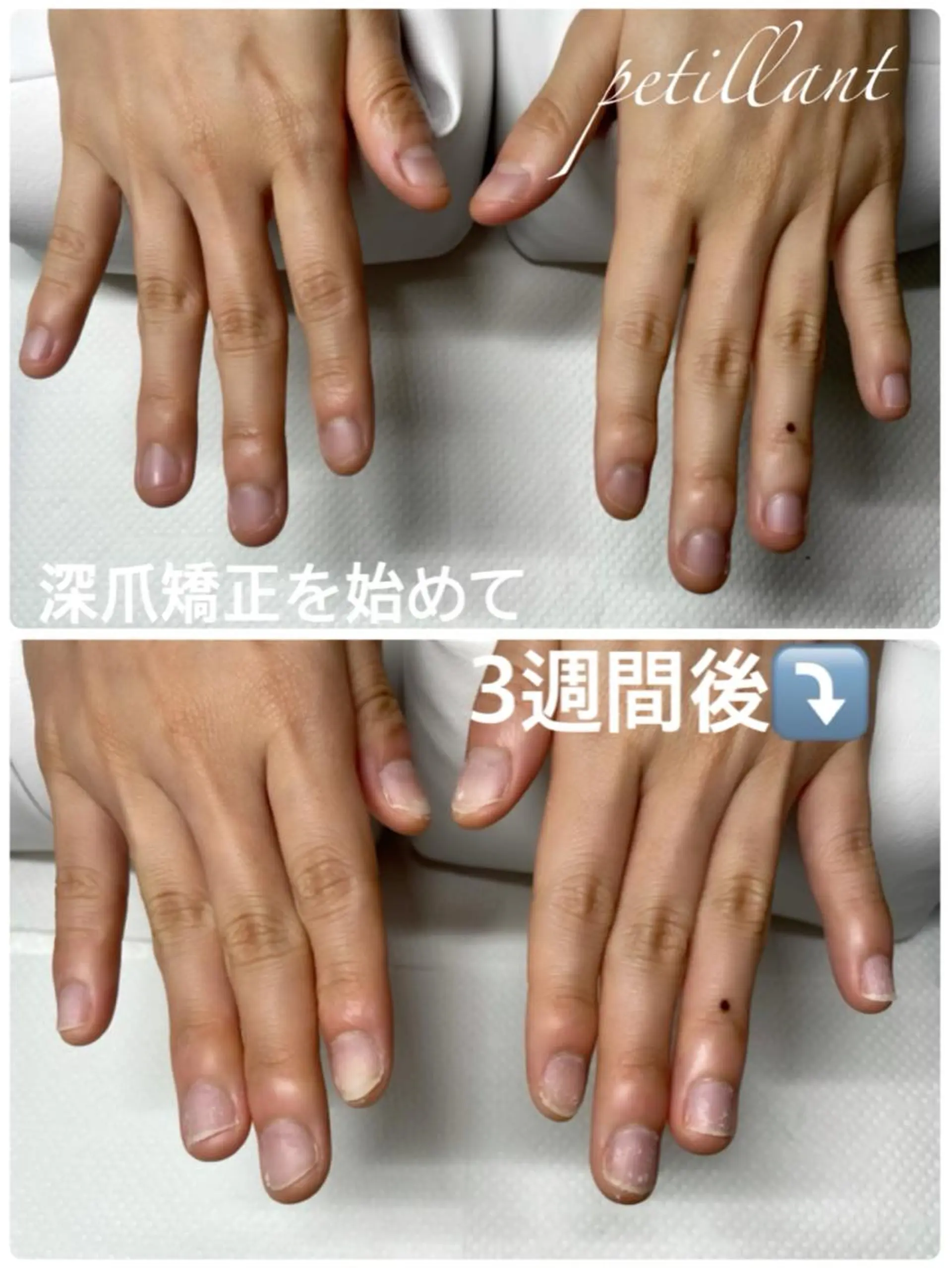 ネイル ピンク ハンドネイル ハンドケア nail salon petillantのネイルデザイン