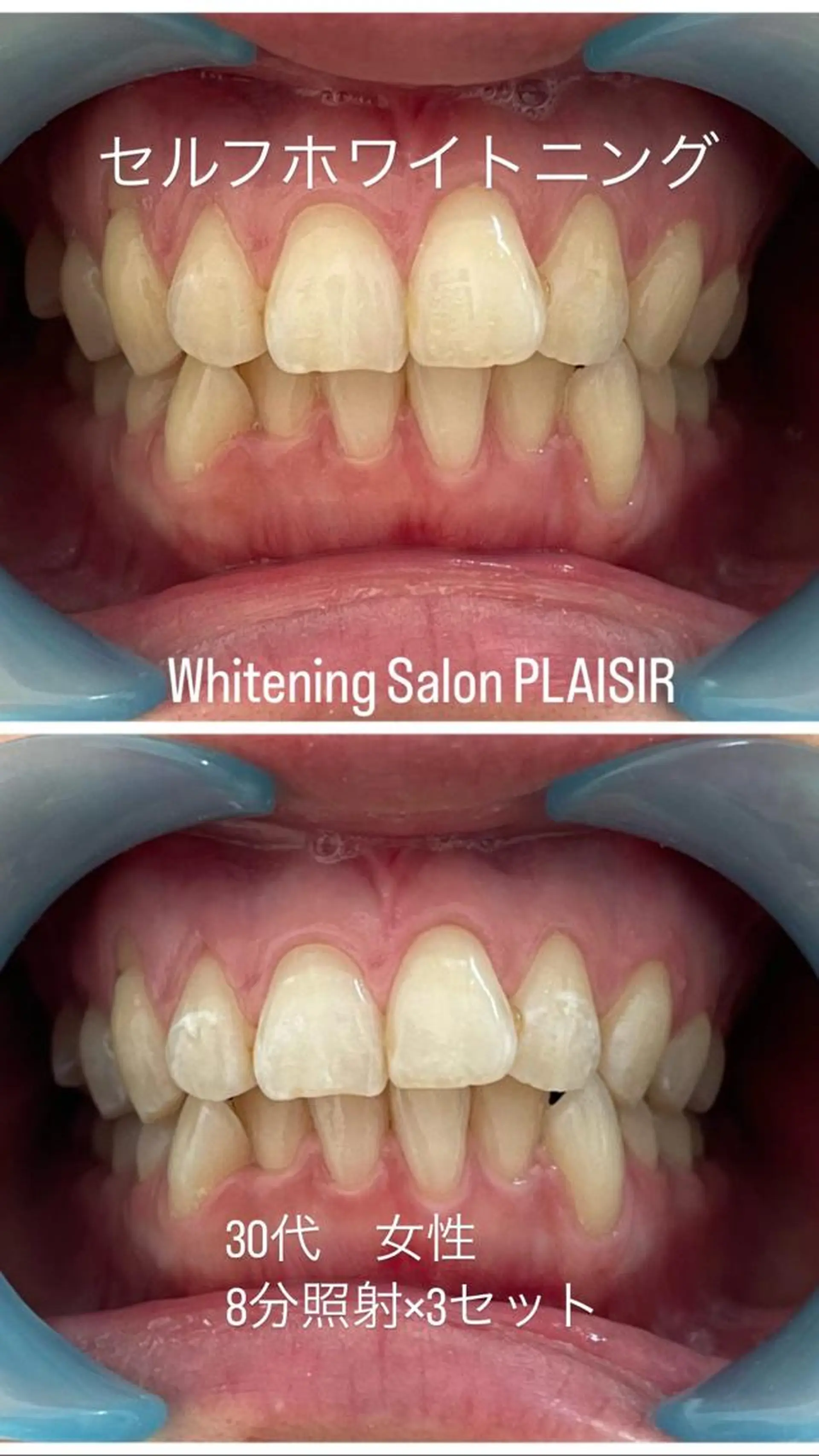 メンズ キッズ その他 ホワイトニングサロン プレジールのエステ・リラクイメージ