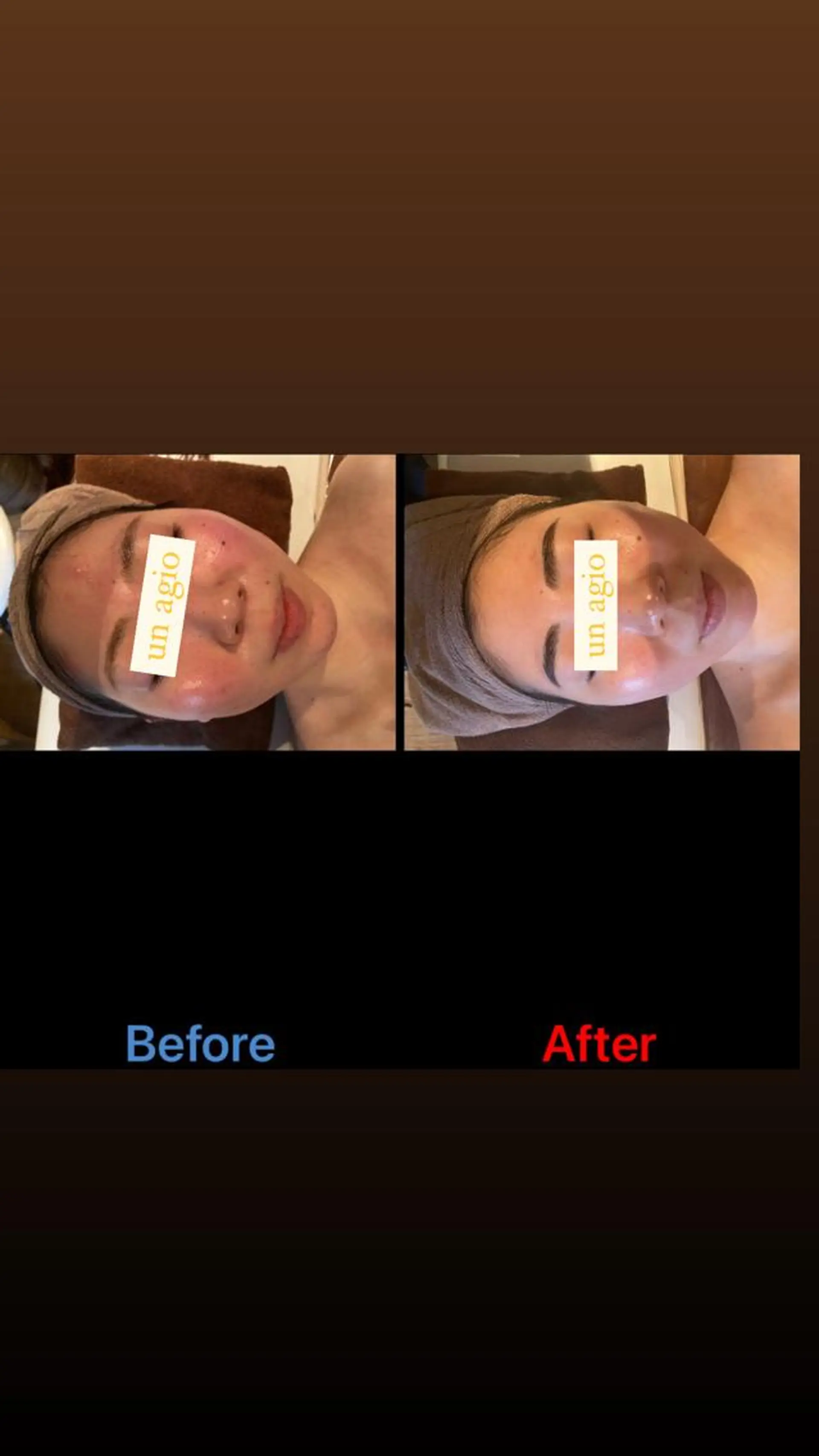 WINBACK salon　un agio所属・サロンドアンアージョ un agioのエステ・リラクイメージ