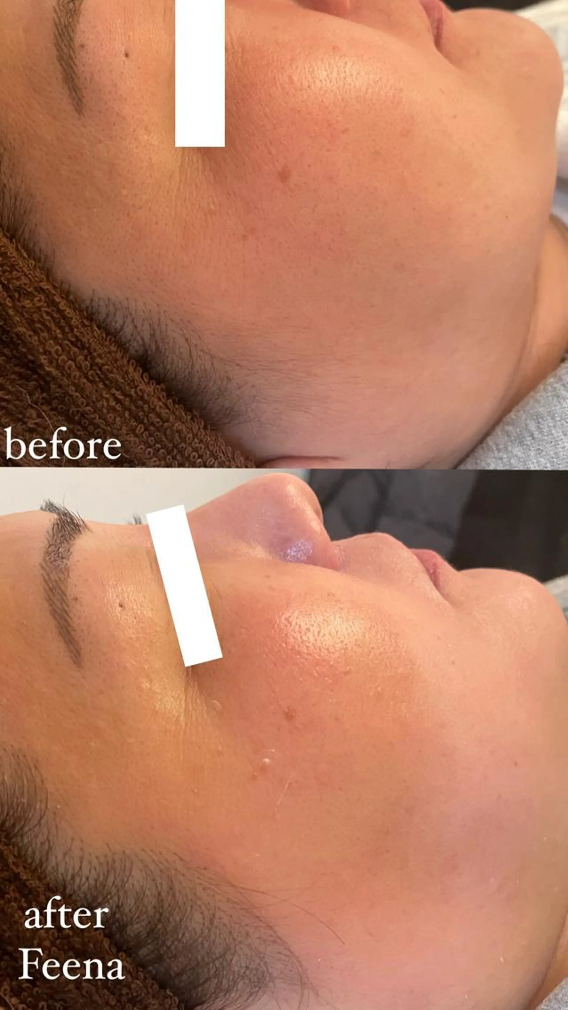 amu nail. RINAのネイルデザイン