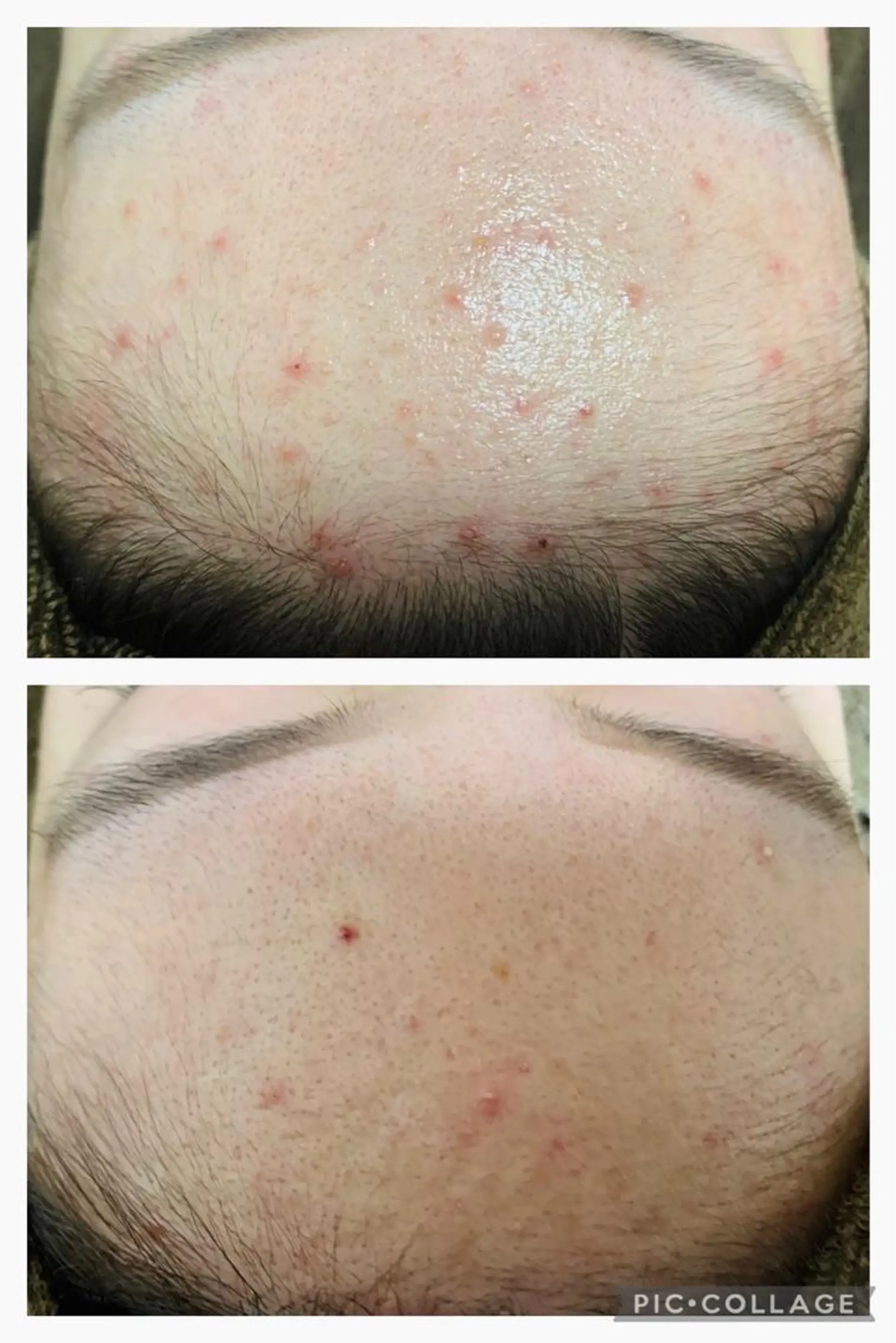 朝重い人専用 肩甲骨調整のエステ・リラクイメージ