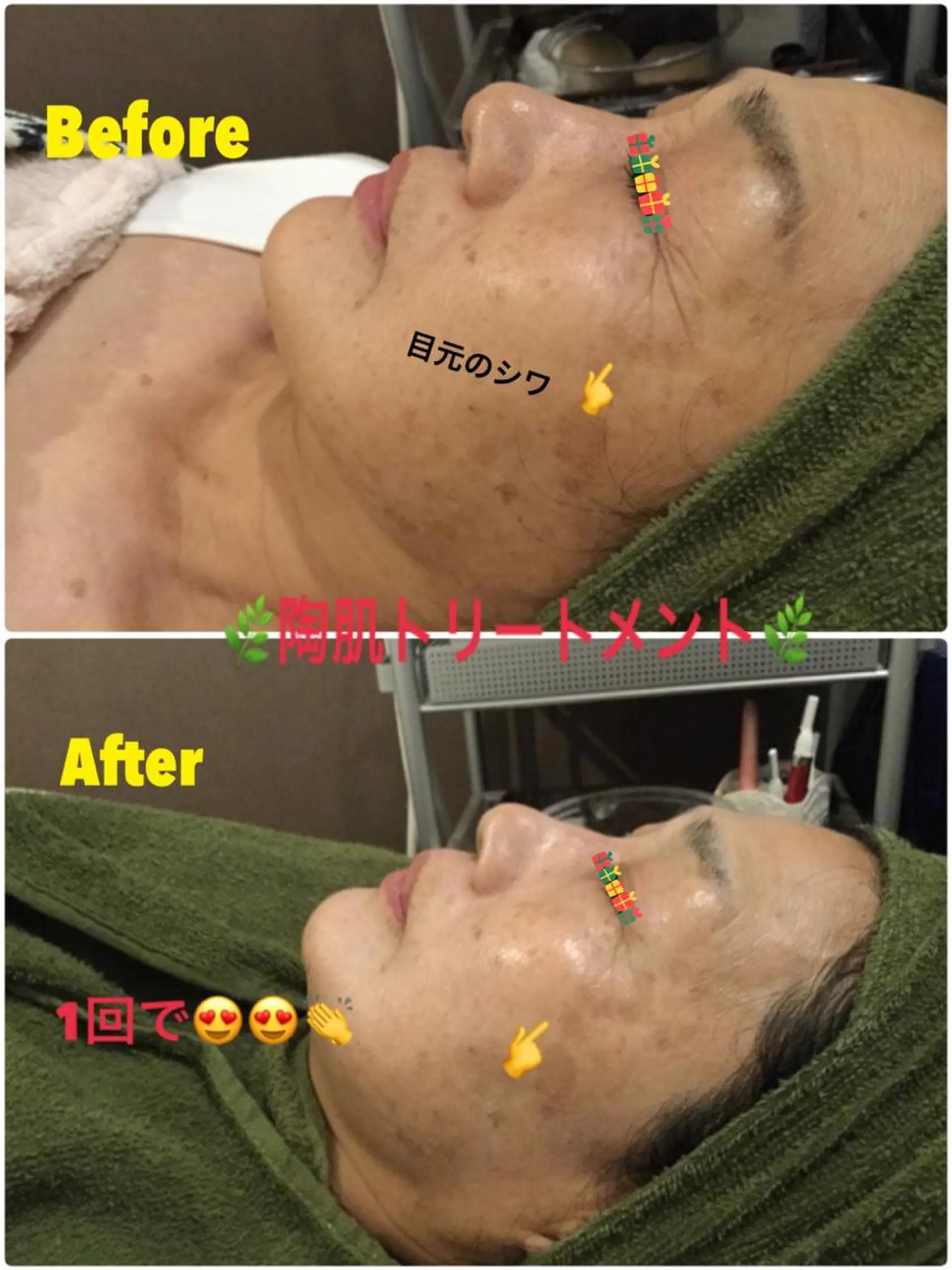 エステ 【リベルハーブピーリング認定店】敏感肌・美白脱毛専門店Dione立川店所属・Dione 立川店のエステ・リラクイメージ