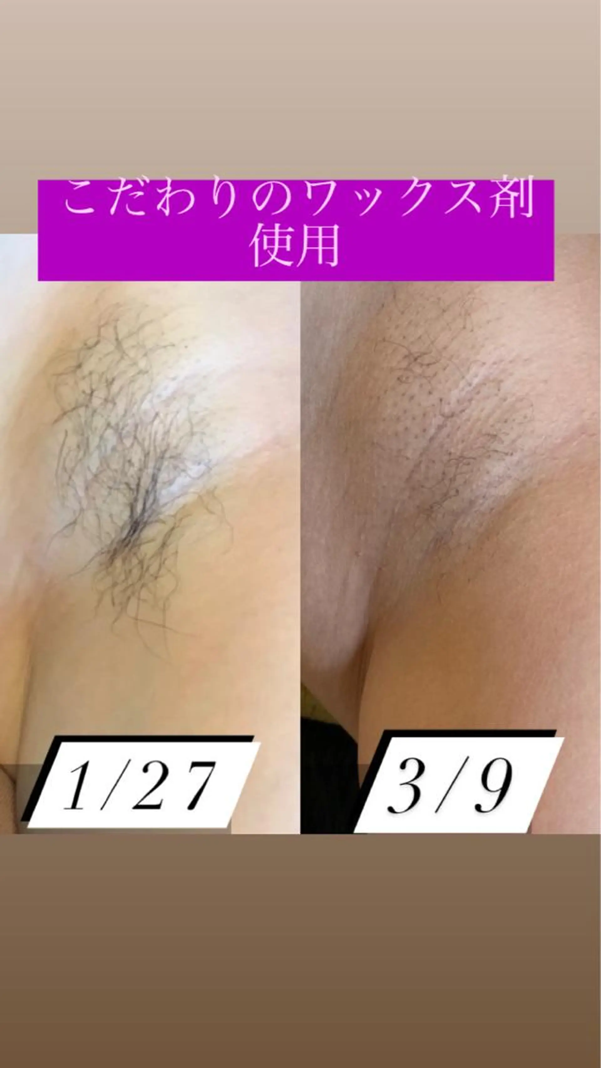 脱毛 産毛専門店 Bittoのエステ・リラクイメージ