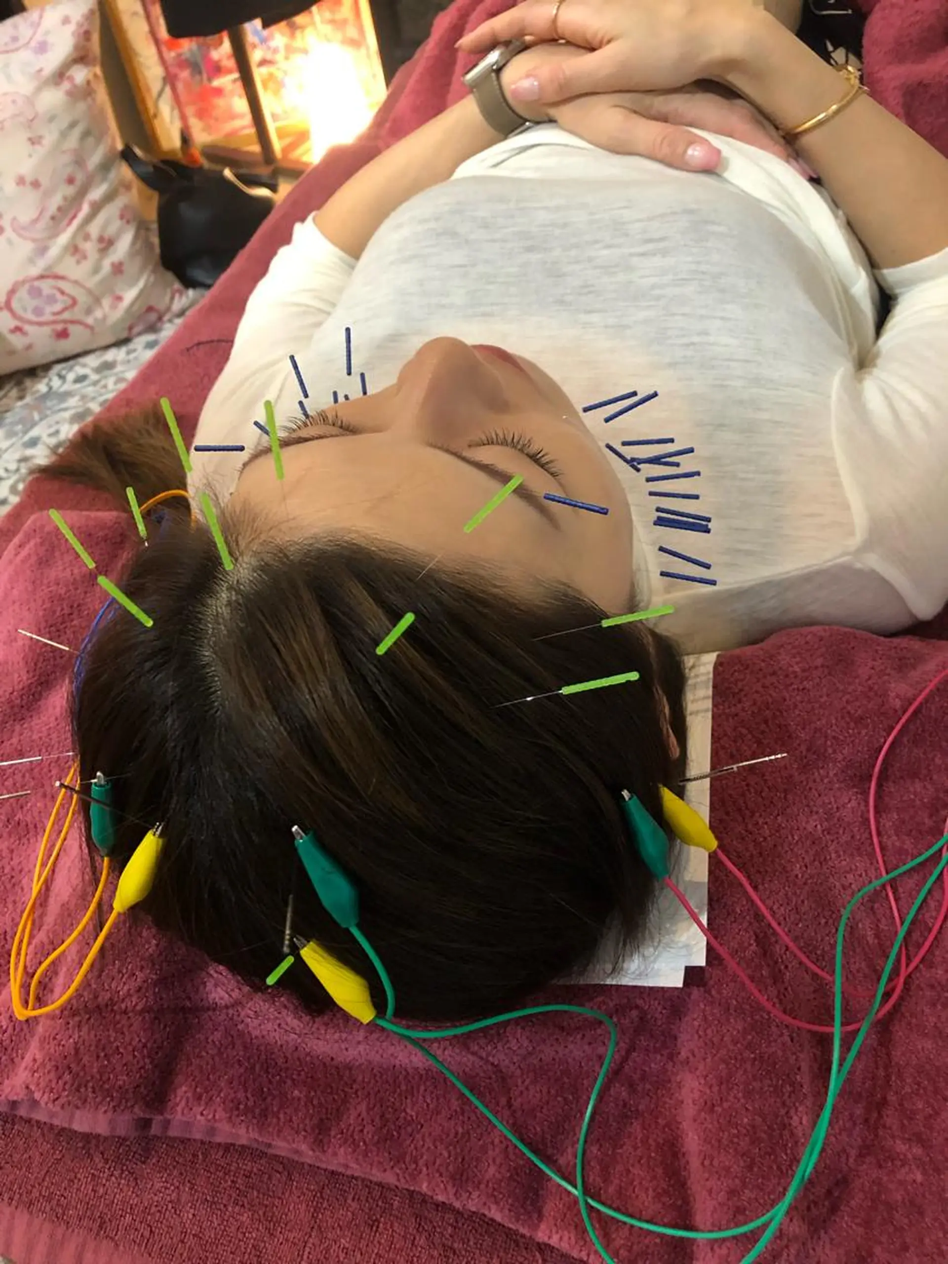 エステ リラク 美容鍼灸女性専用 りんご鍼灸治療院のその他イメージ