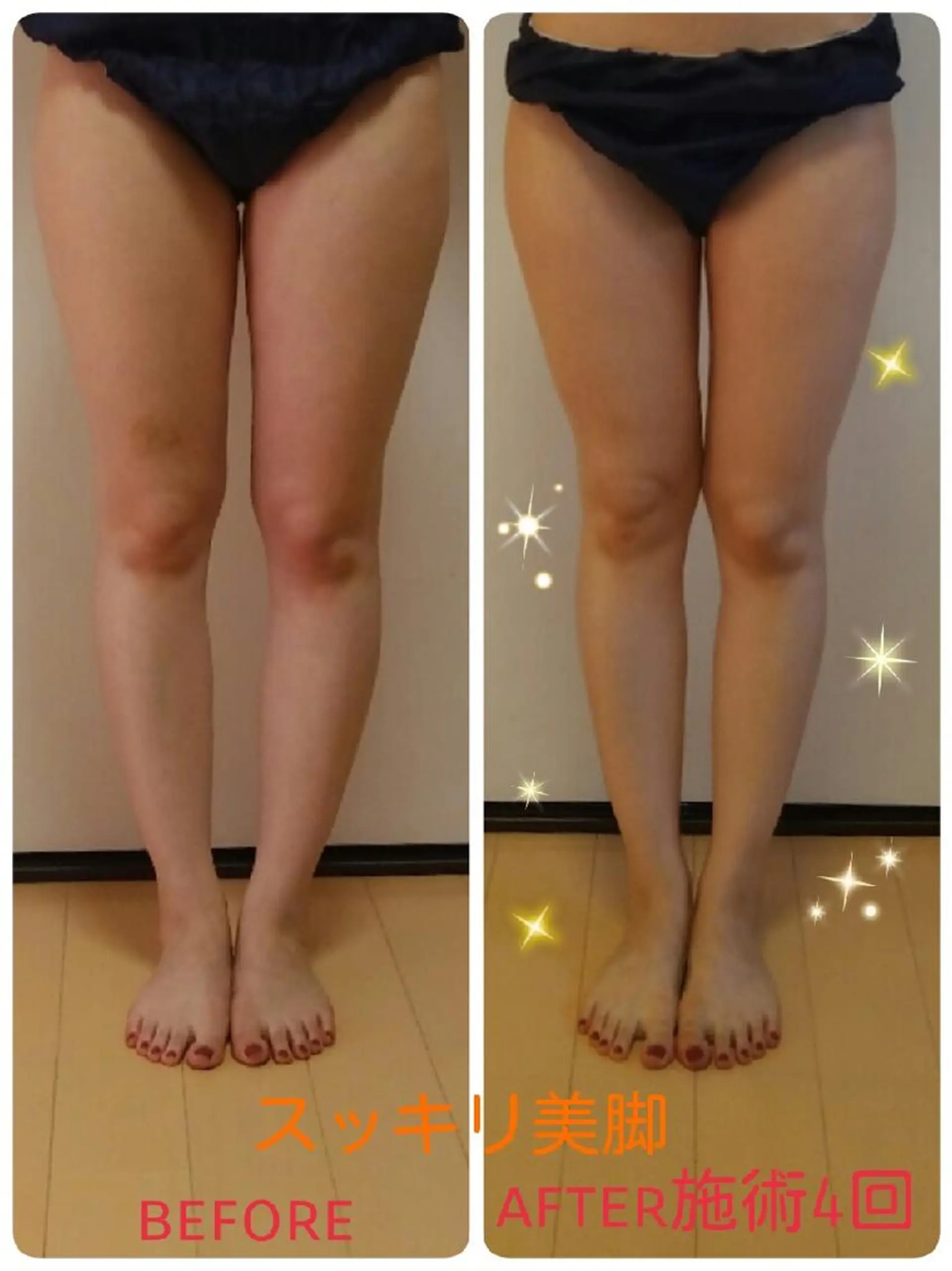 リンパサロン レディ ワンのエステ・リラクイメージ