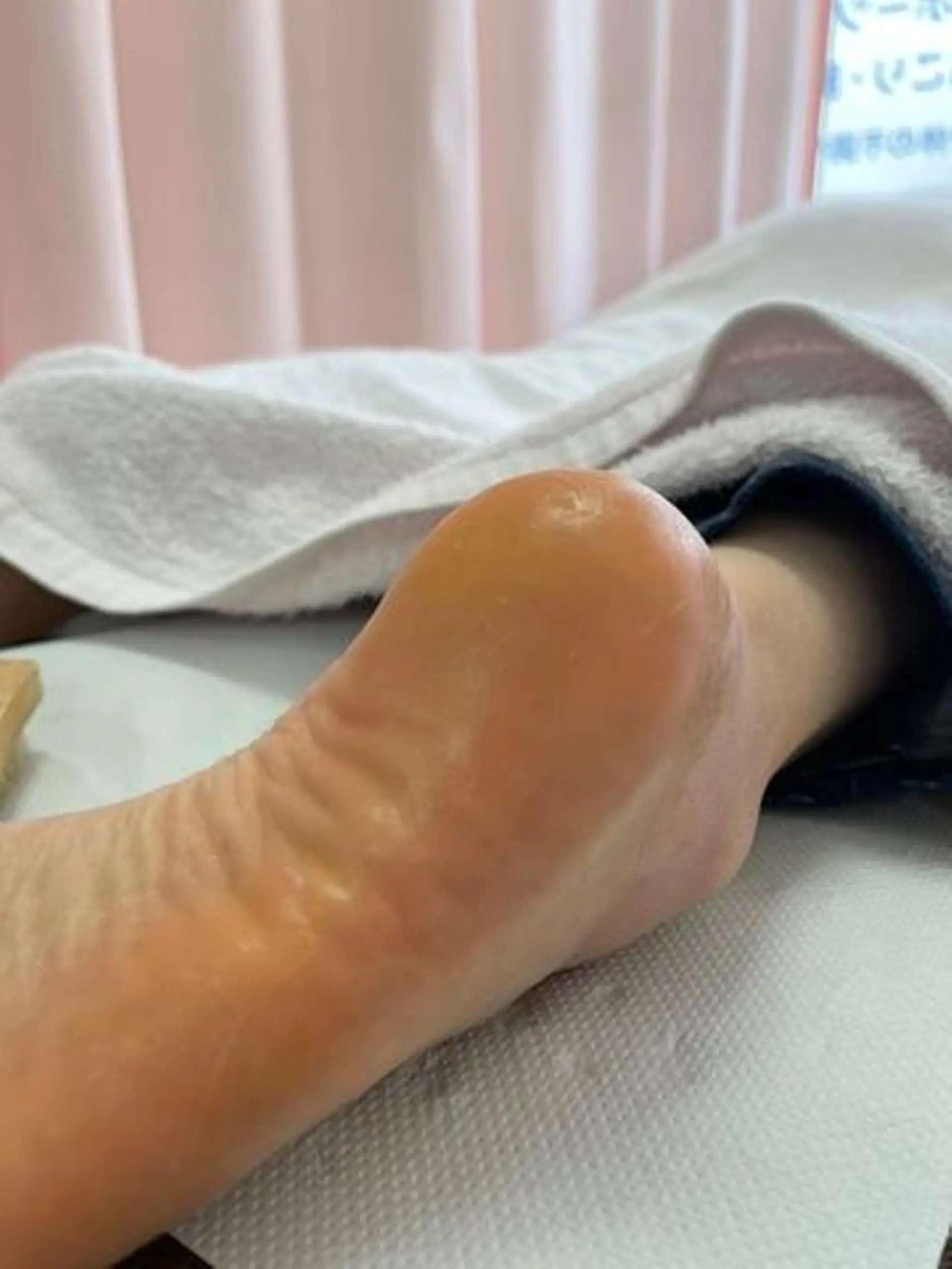 ネイル フットネイル 同心整骨院 美容鍼・整体・小顔のエステ・リラクイメージ