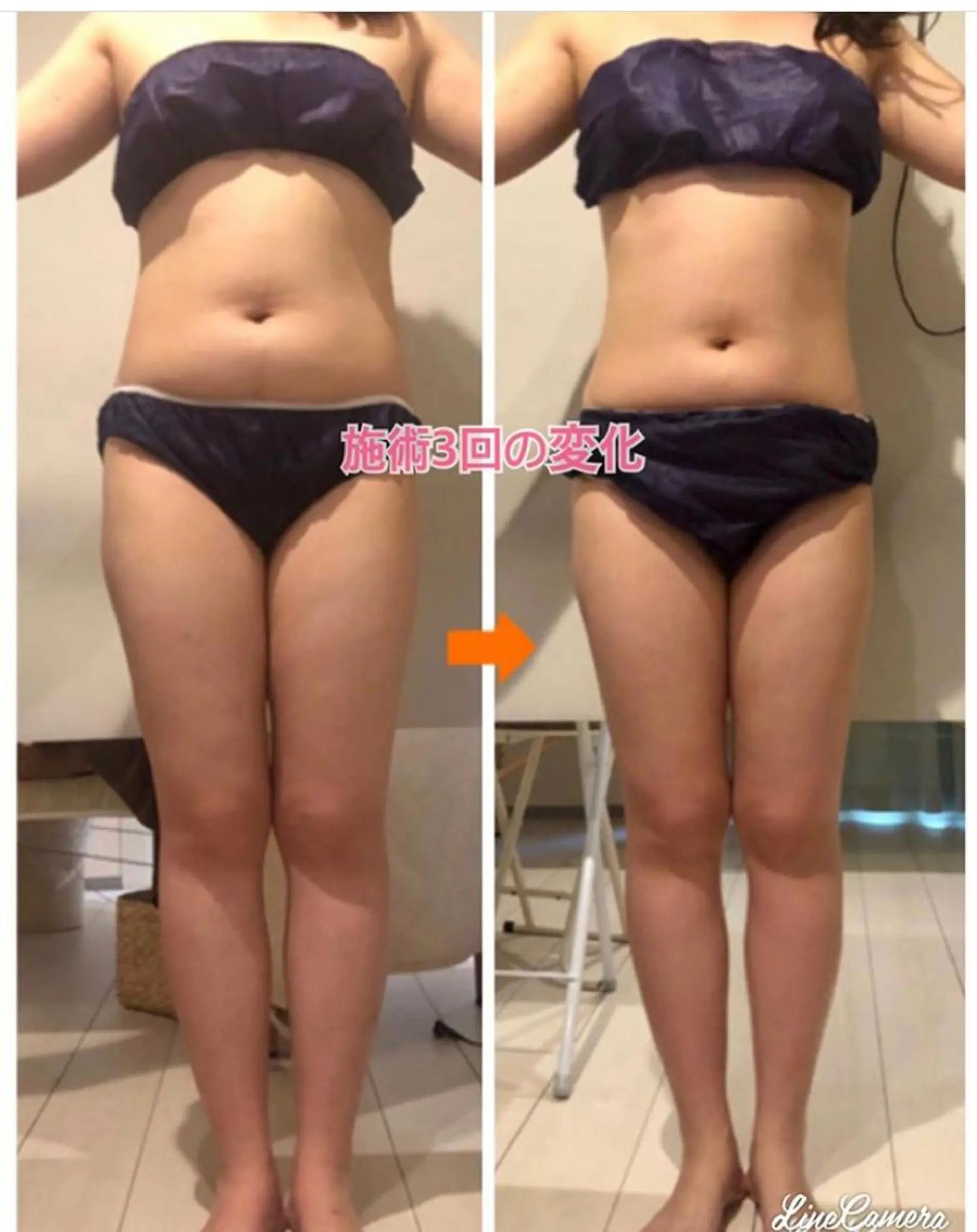 ショート カラー パーマ ヘアアレンジ メンズ キッズ ネイル マツエク・マツパ エステ リラク ‍痩身＆ボディ 結果出し🌟丹野のエステ・リラクイメージ