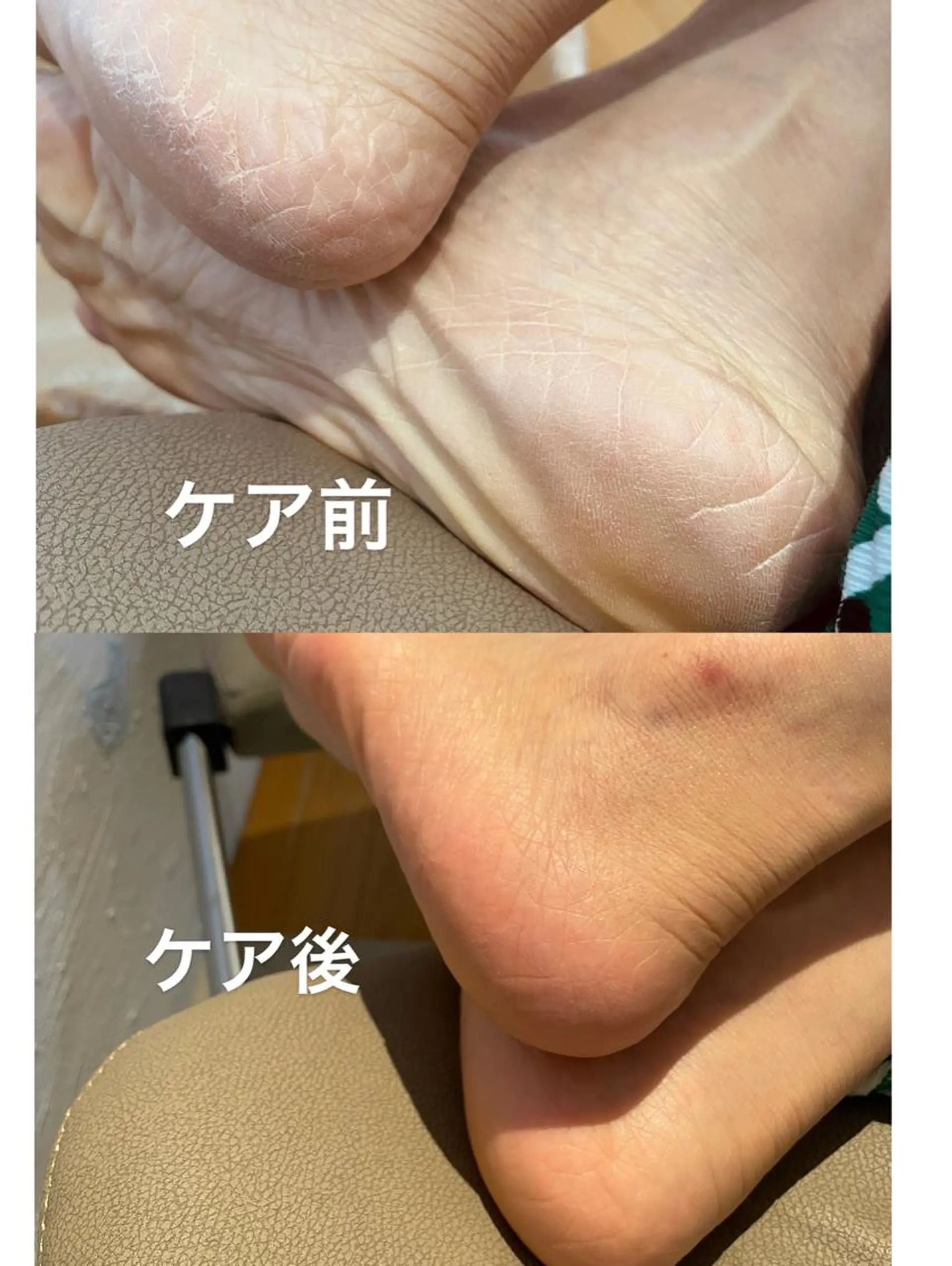 ネイル 南野 由希のネイルデザイン