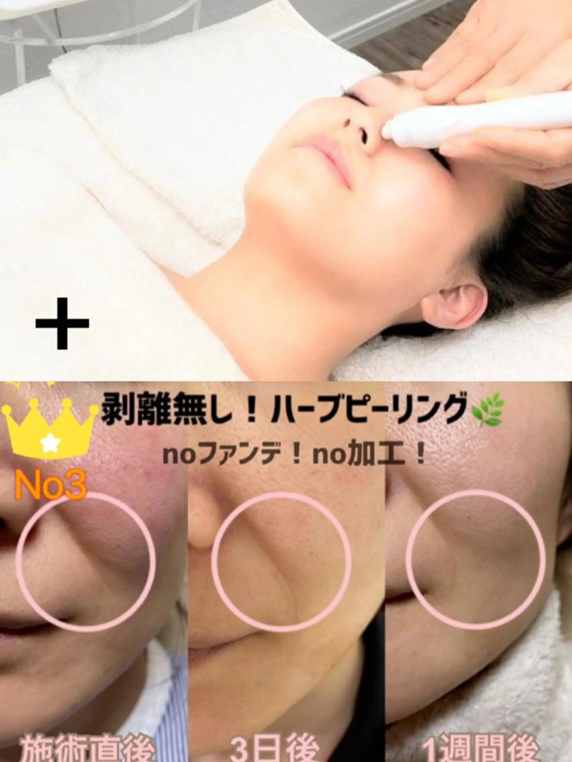 エステ 肌ケア＆毛穴洗浄 Cheri/女性専用のエステ・リラクイメージ