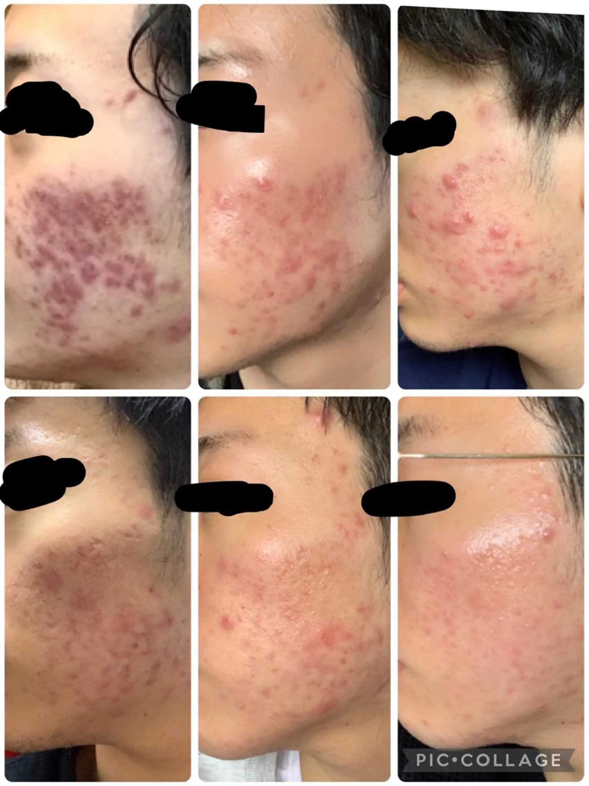 メンズ 朝重い人専用 肩甲骨調整のエステ・リラクイメージ