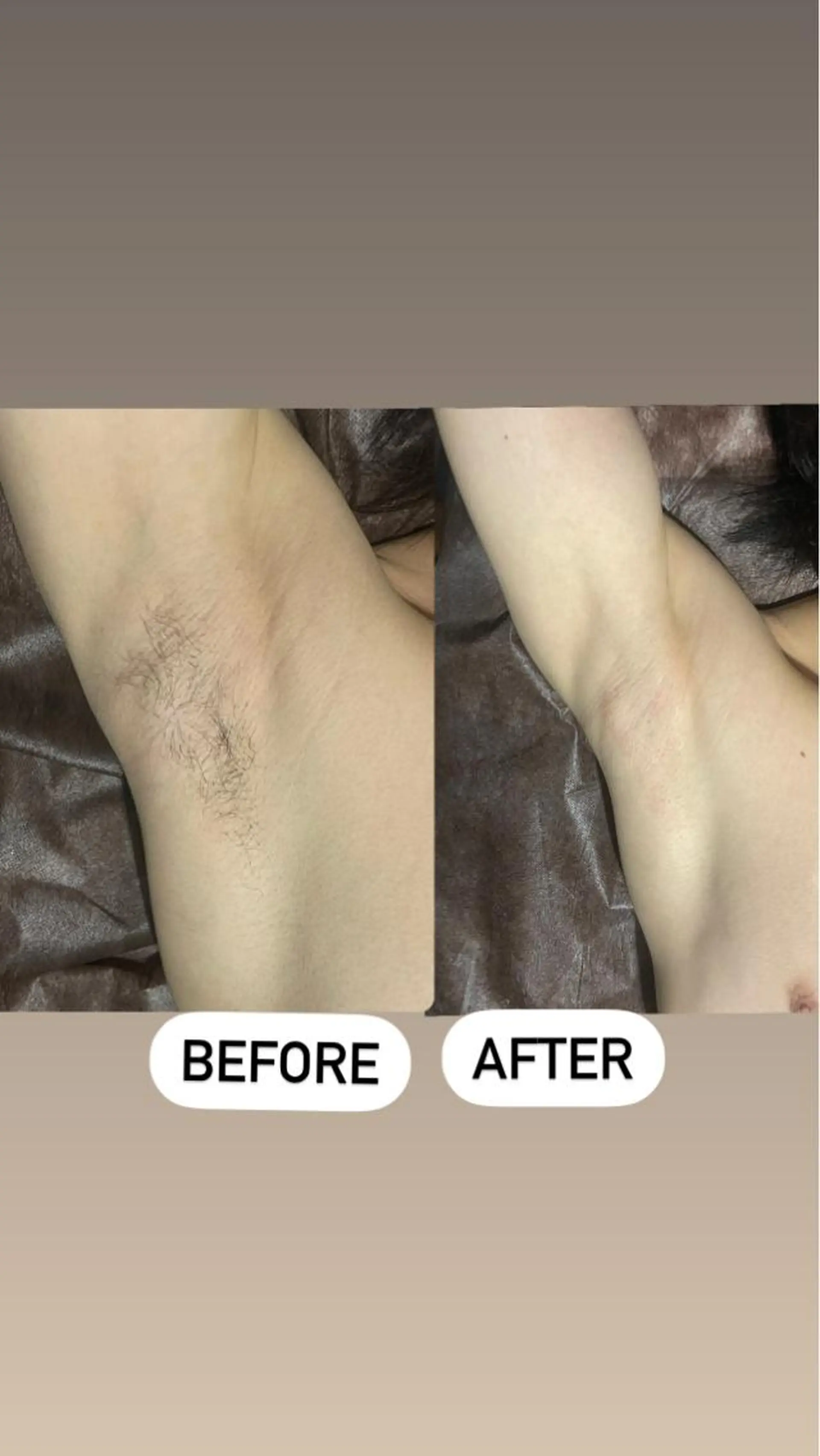 メンズ 脱毛 メンズ眉毛ITSUK Iメンズ専門　新宿の眉毛・アイブロウイメージ