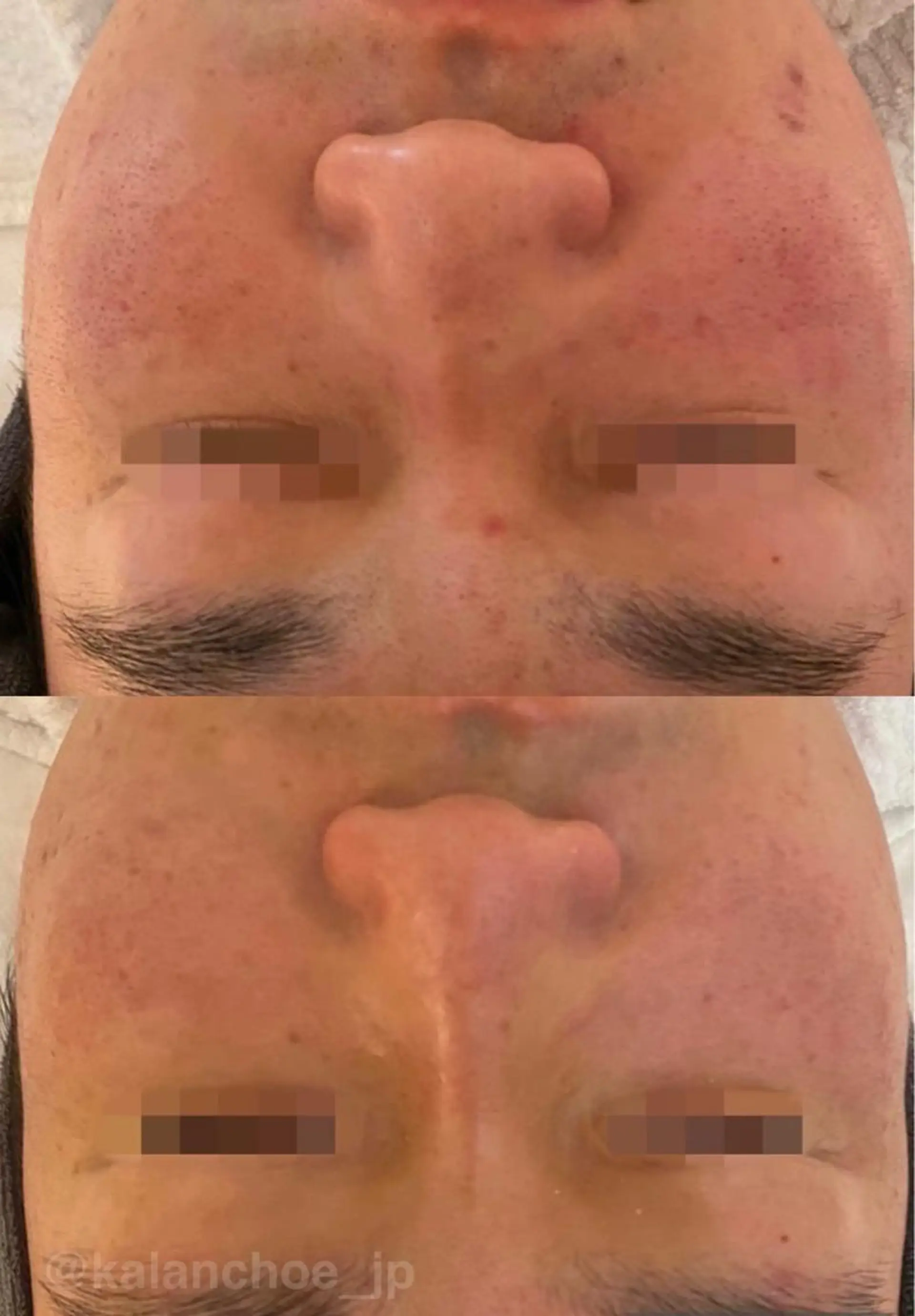 エステ 肌質改善 KALANCHOEのエステ・リラクイメージ